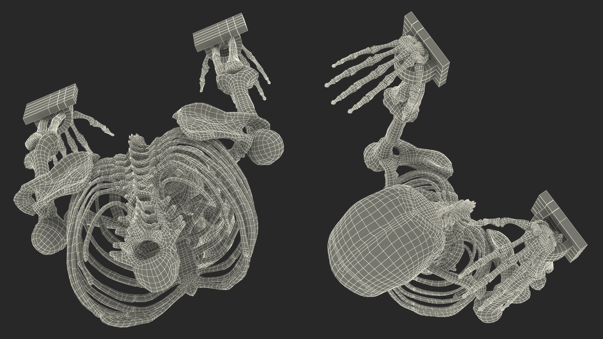 3D Human Male Remains Skeleton Shackled