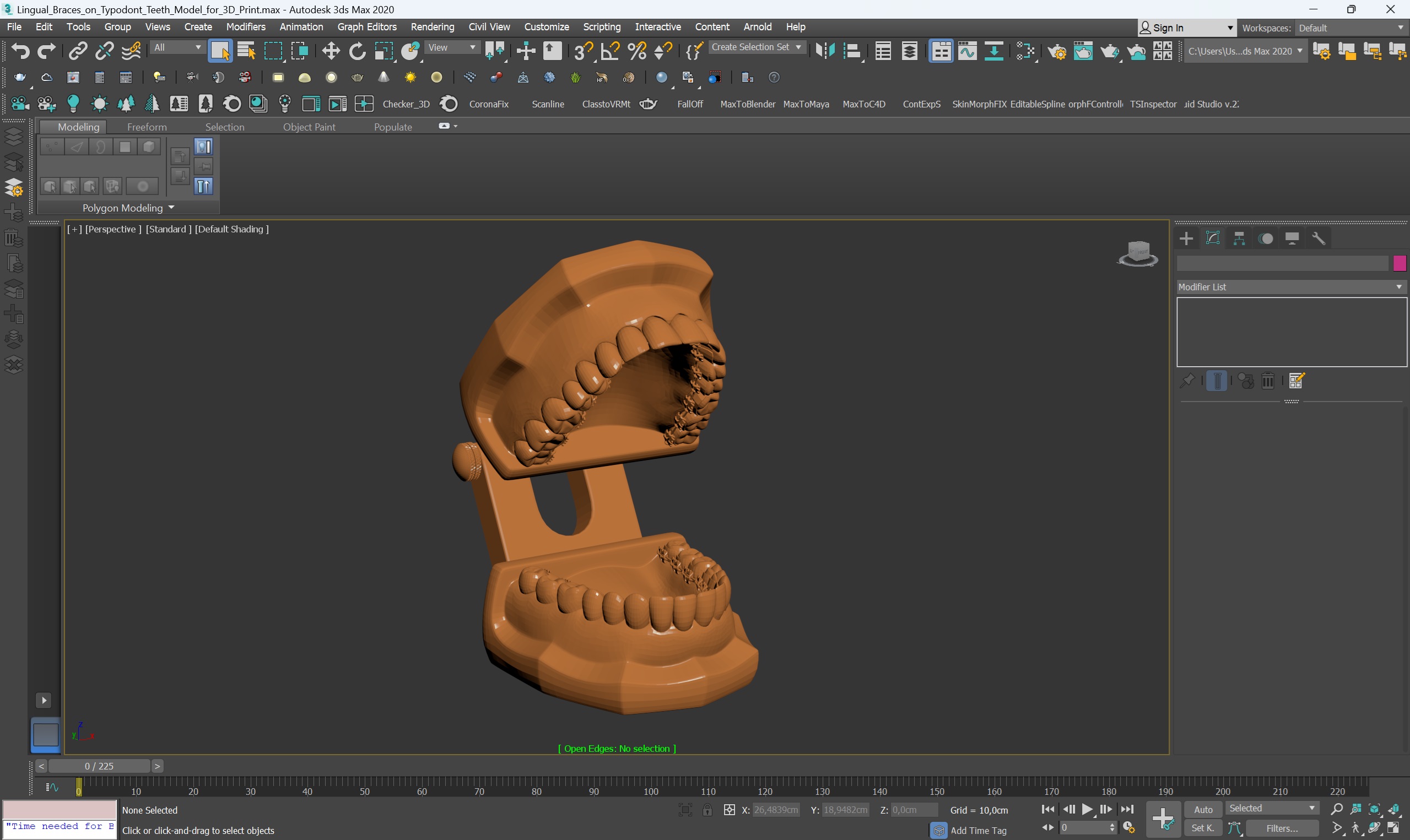 3D Lingual Braces on Typodont Teeth Model for 3D Print