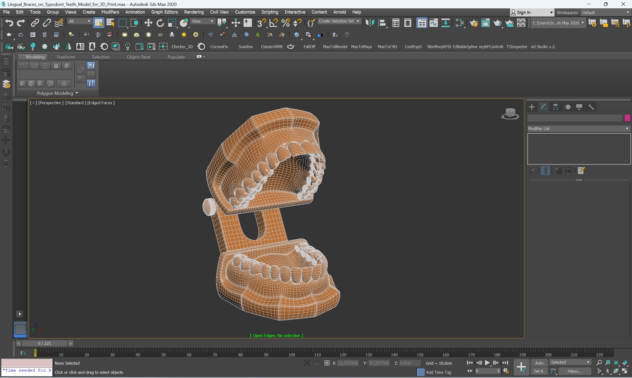 3D Lingual Braces on Typodont Teeth Model for 3D Print