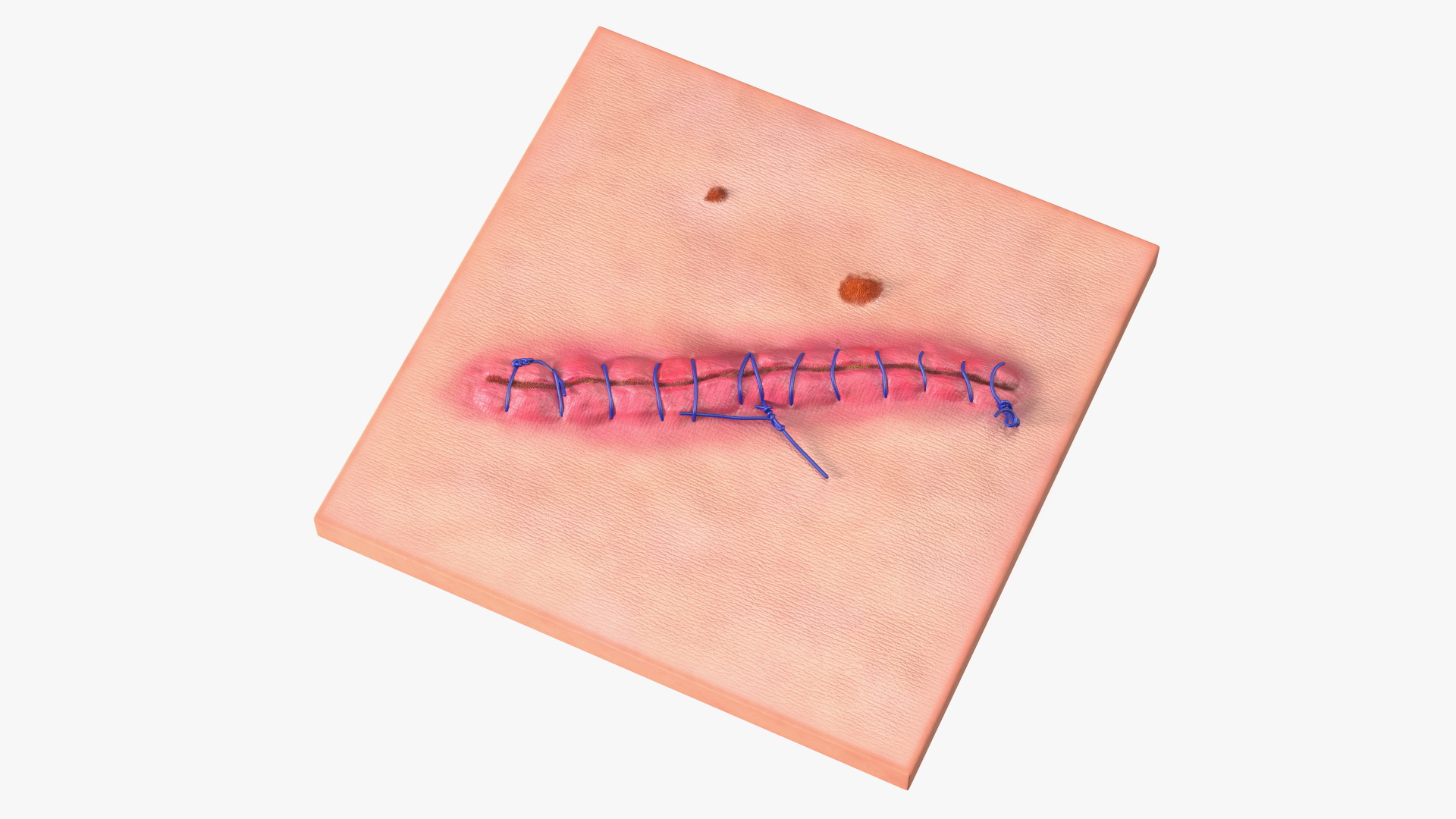 Skin with Medical Seam Open 3D