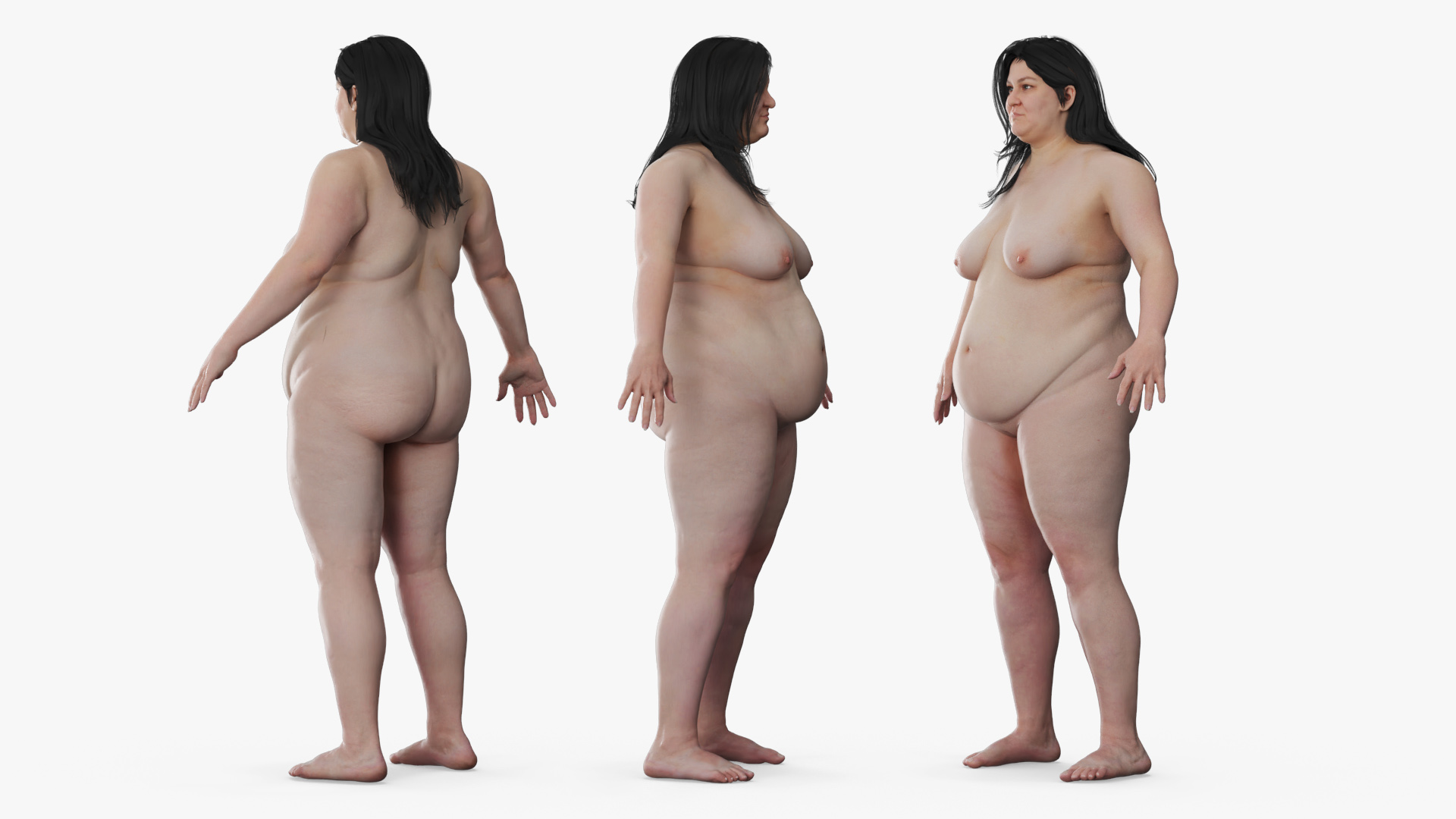 Inpatient Medical Gown on Plus Size Woman - view 8