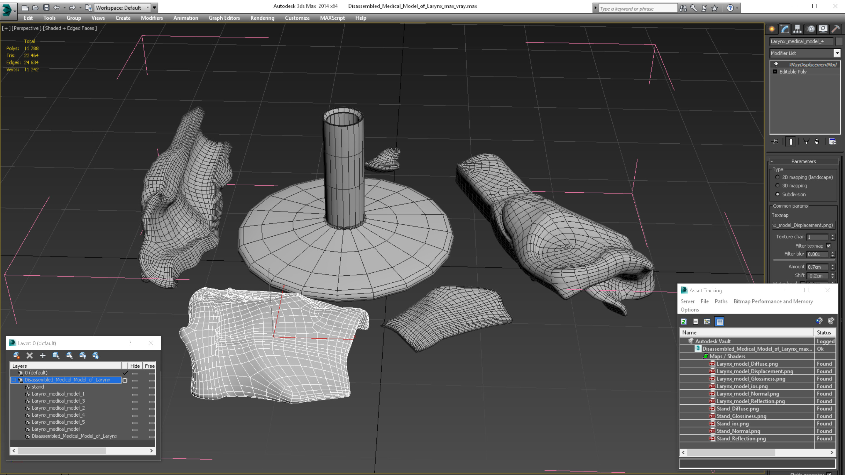 3D Disassembled Medical Model of Larynx