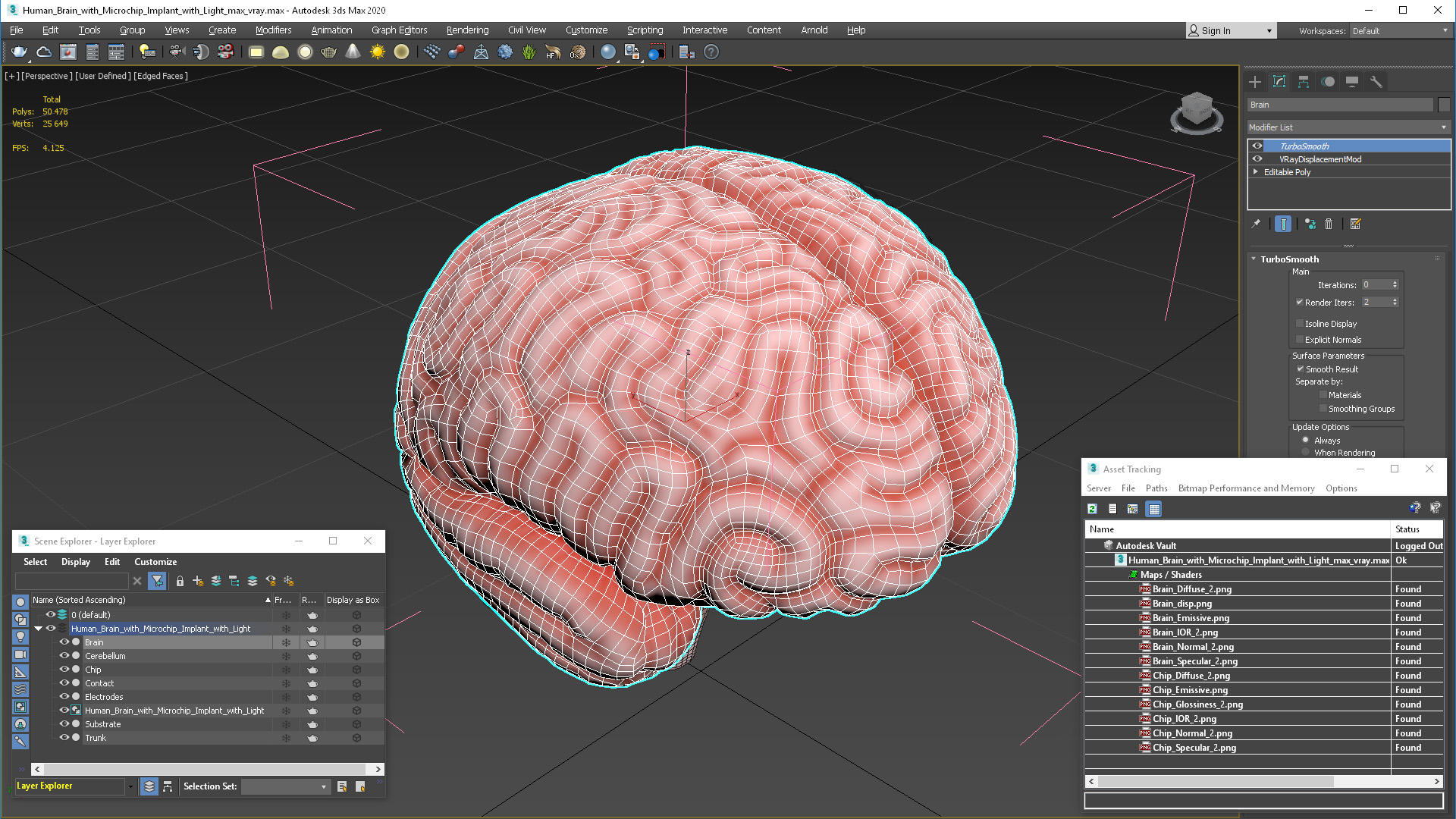 3D model Human Brain with Microchip Implant with Light
