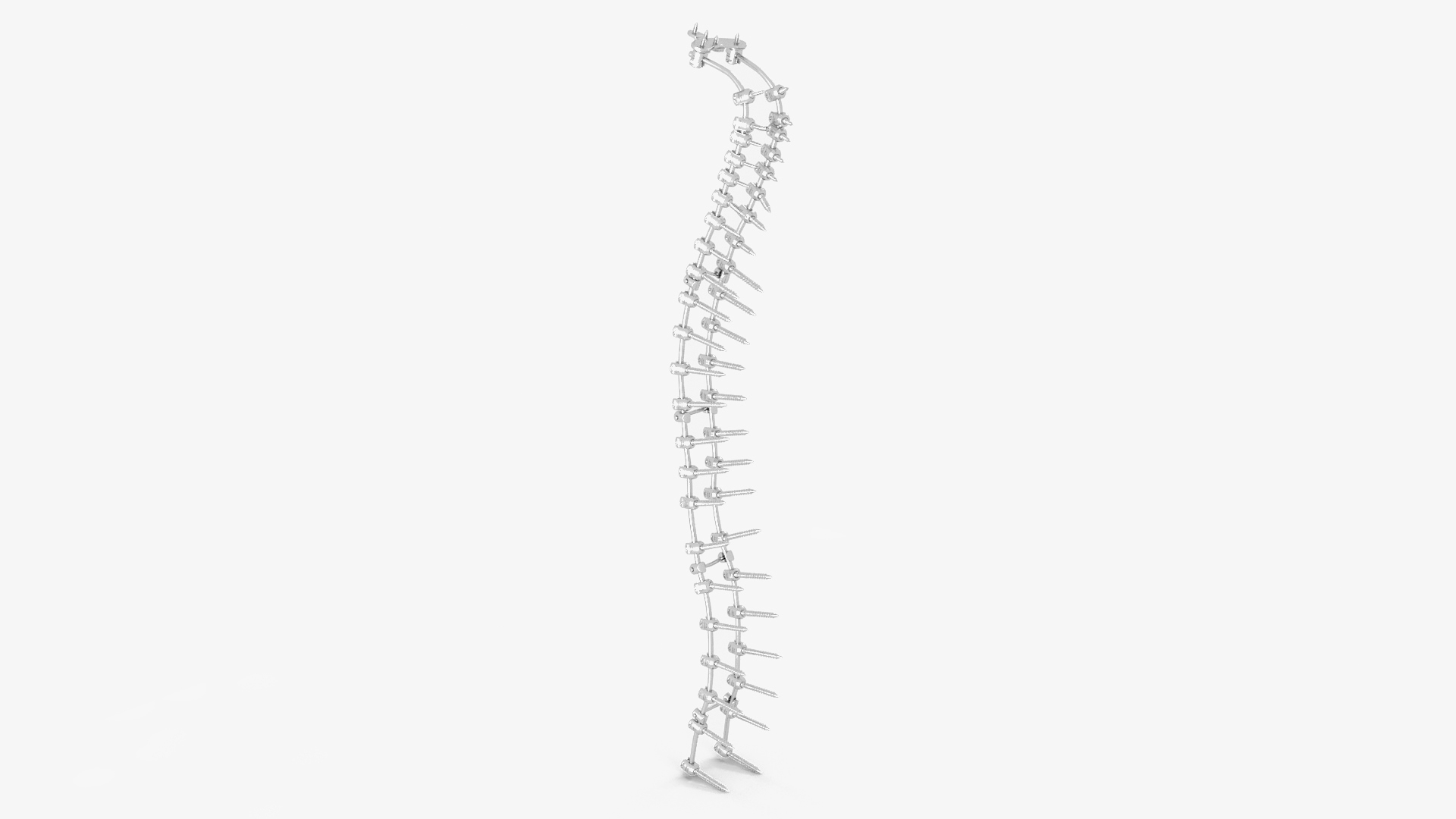 3D Spine Fixation System