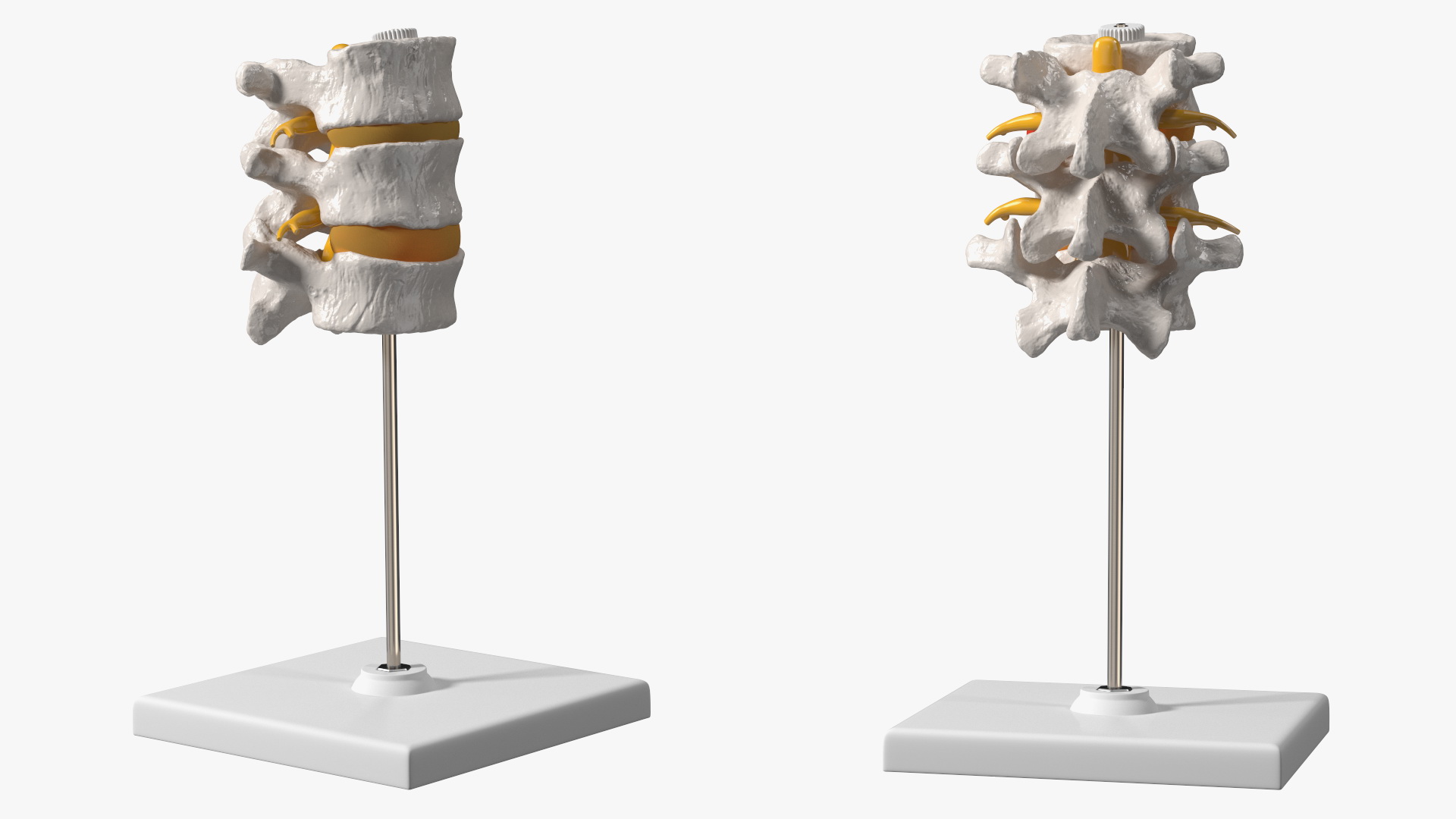 3D Herniated Vertebrae on Medical Stand