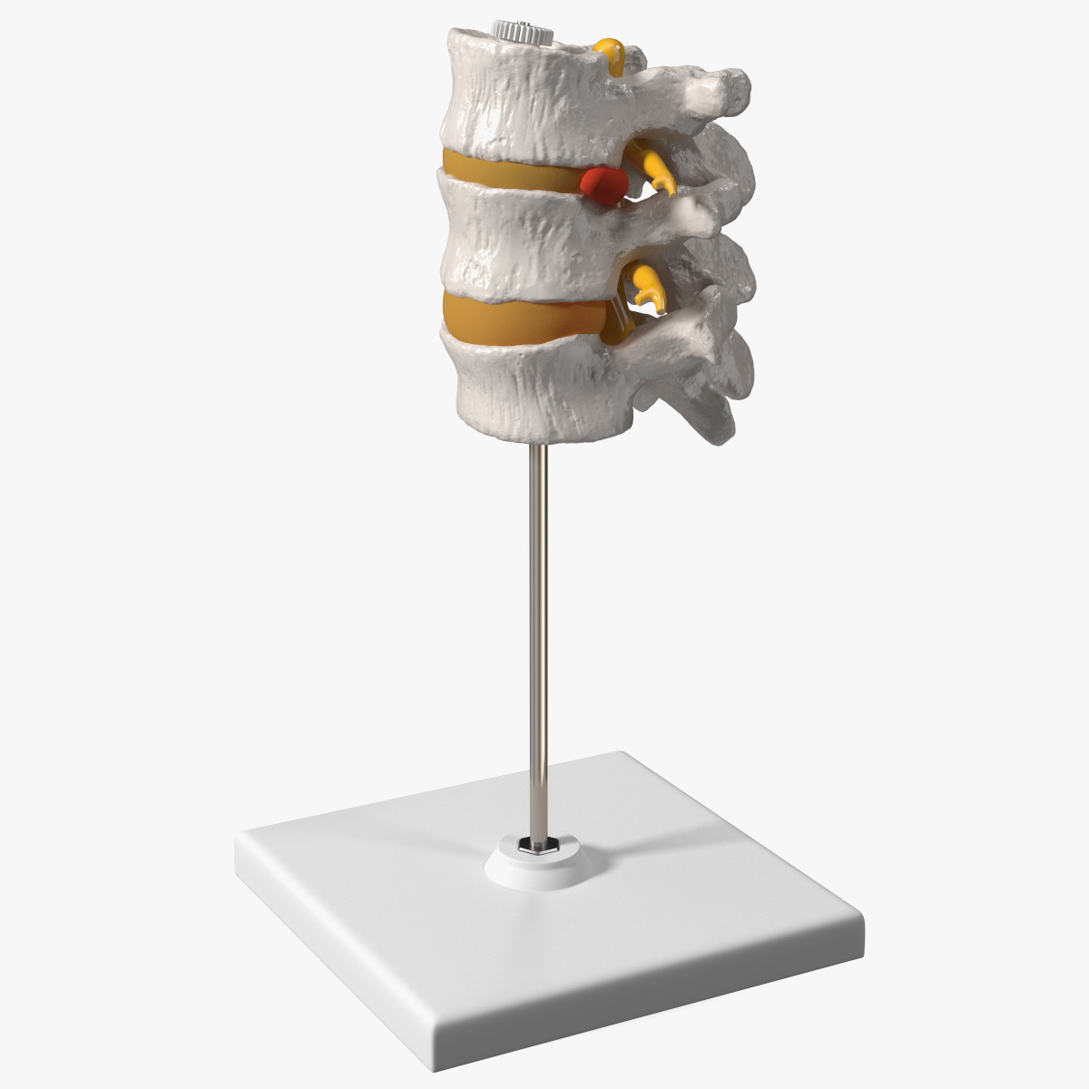 Herniated Vertebrae on Medical Stand, view 2