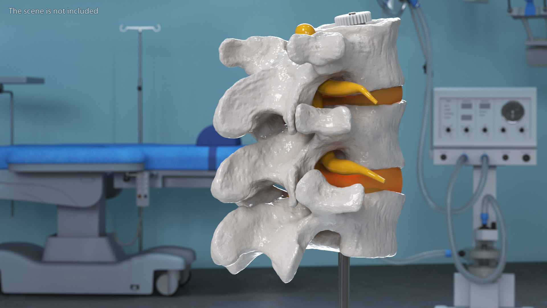 3D Herniated Vertebrae on Medical Stand