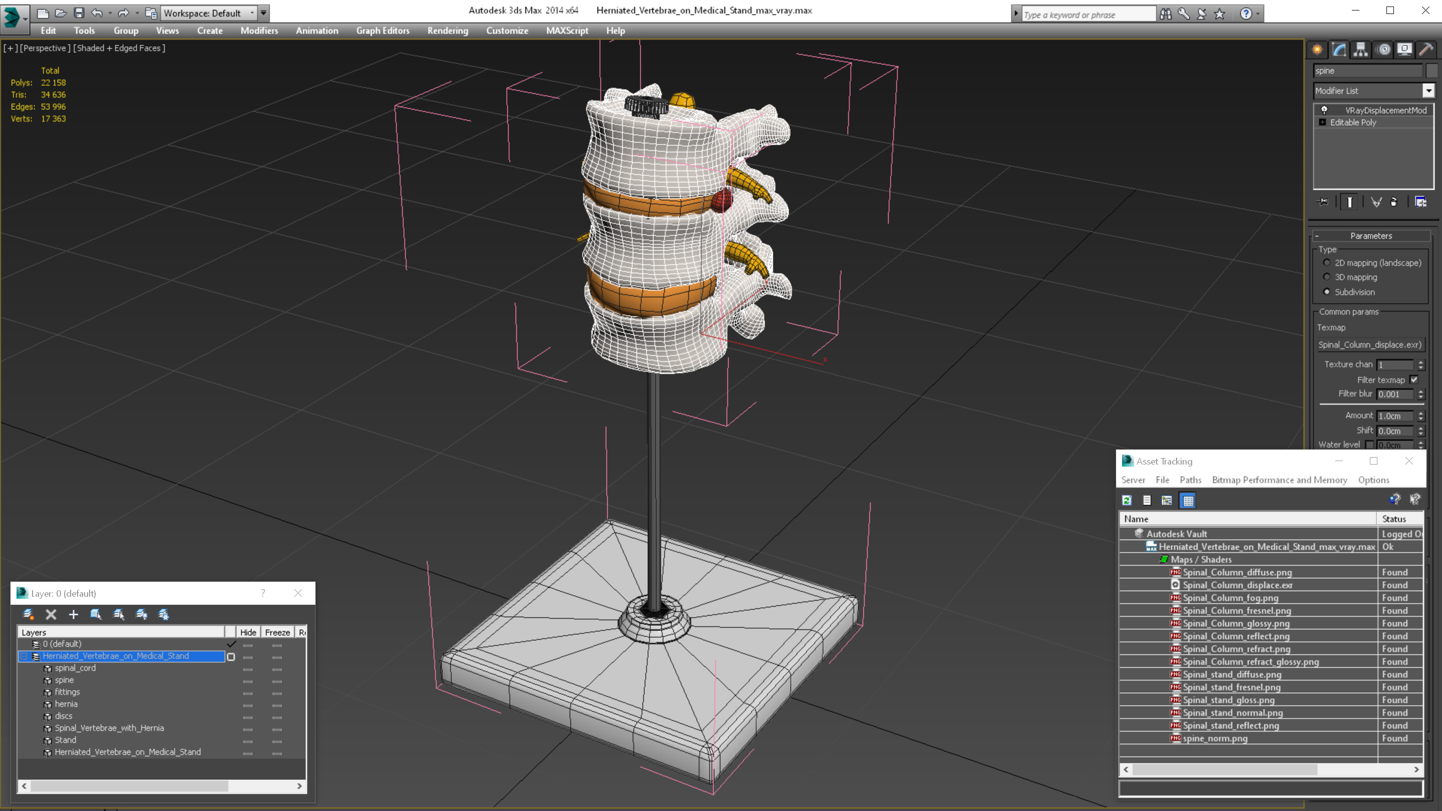3D Herniated Vertebrae on Medical Stand