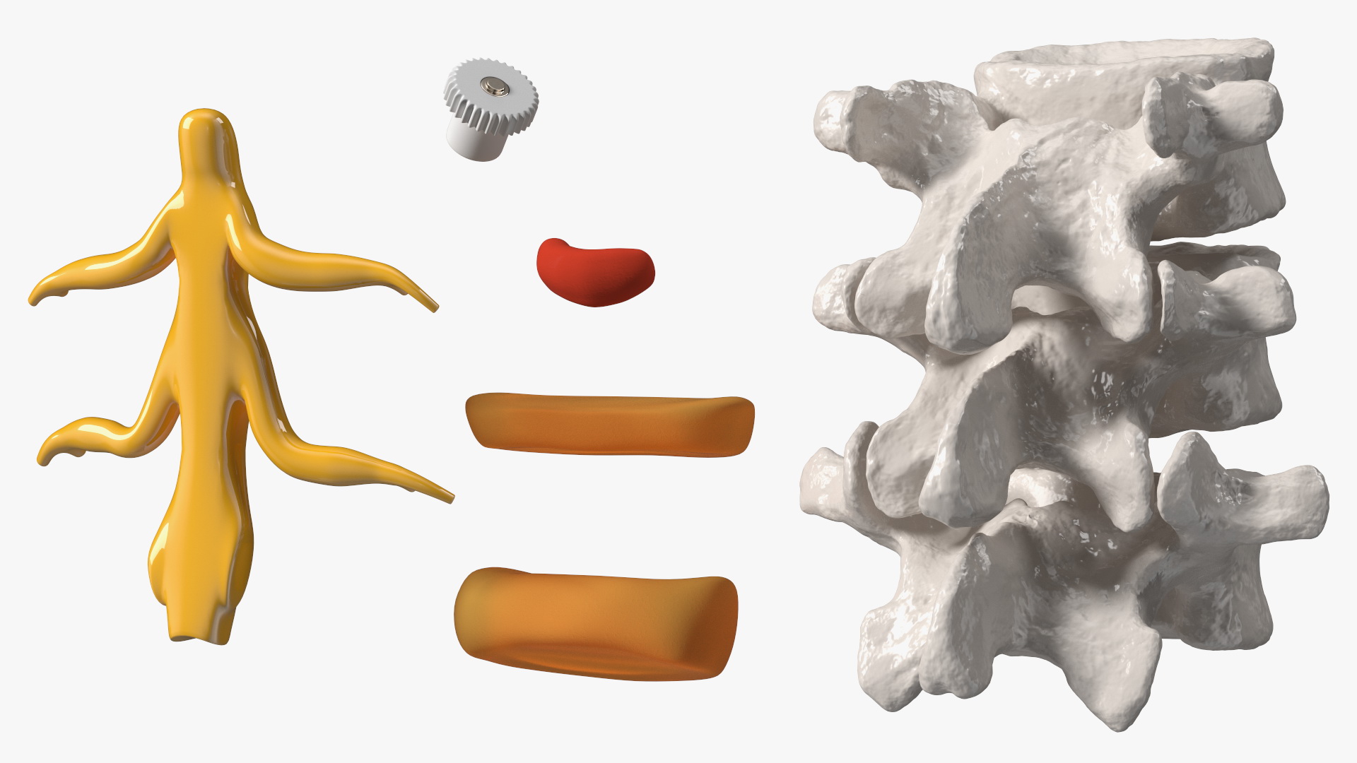 3D Herniated Vertebrae on Medical Stand