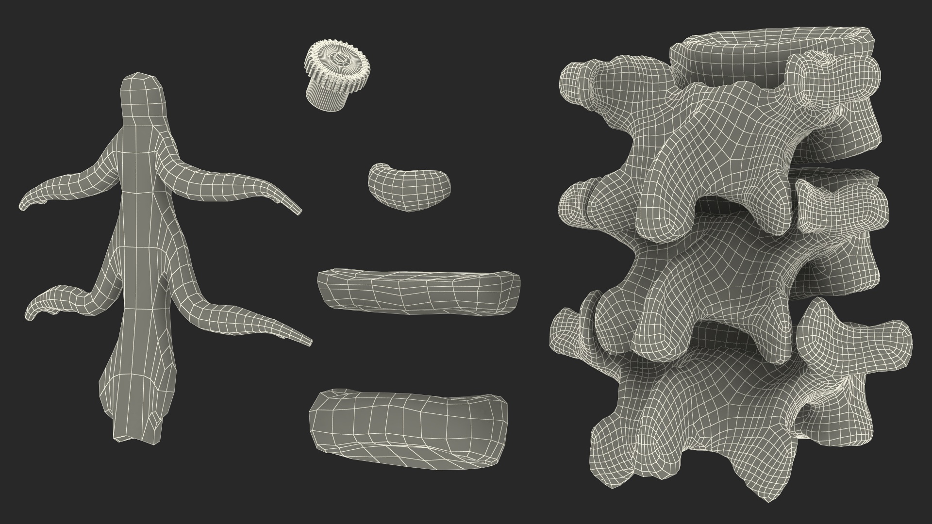 3D Herniated Vertebrae on Medical Stand