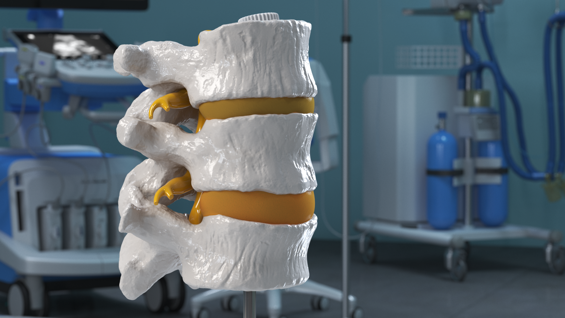 Herniated Vertebrae on Medical Stand, view 10