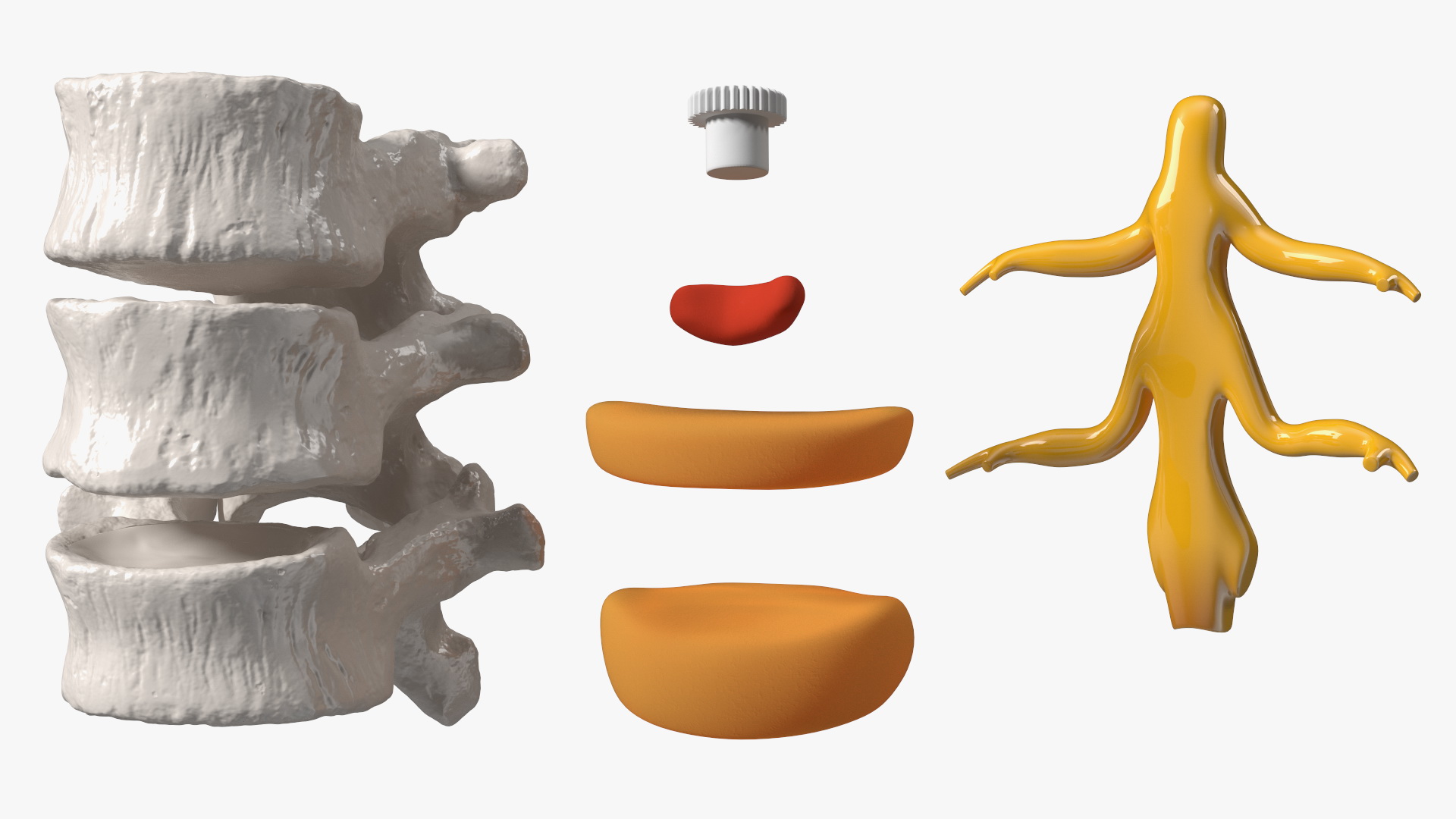3D Herniated Vertebrae on Medical Stand