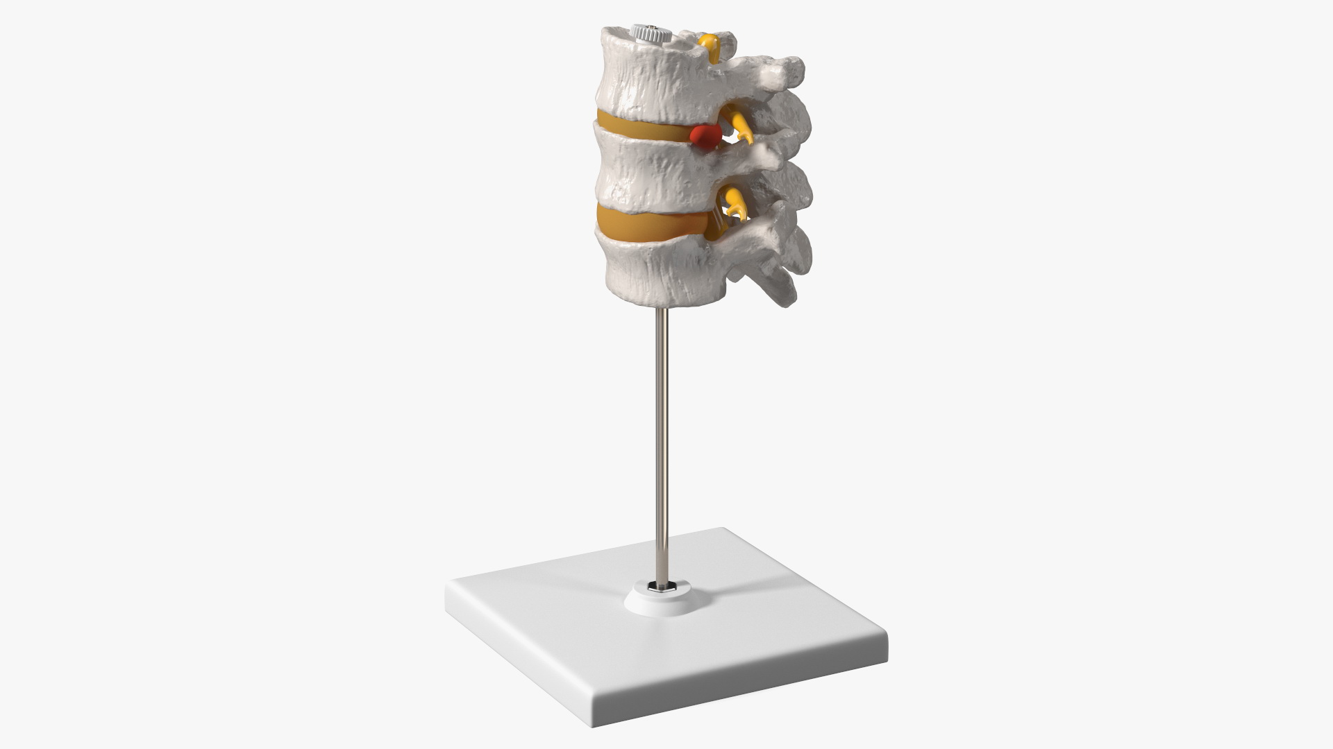 3D Herniated Vertebrae on Medical Stand