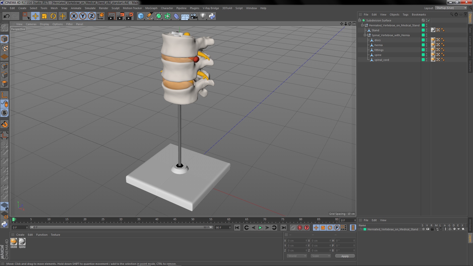 3D Herniated Vertebrae on Medical Stand