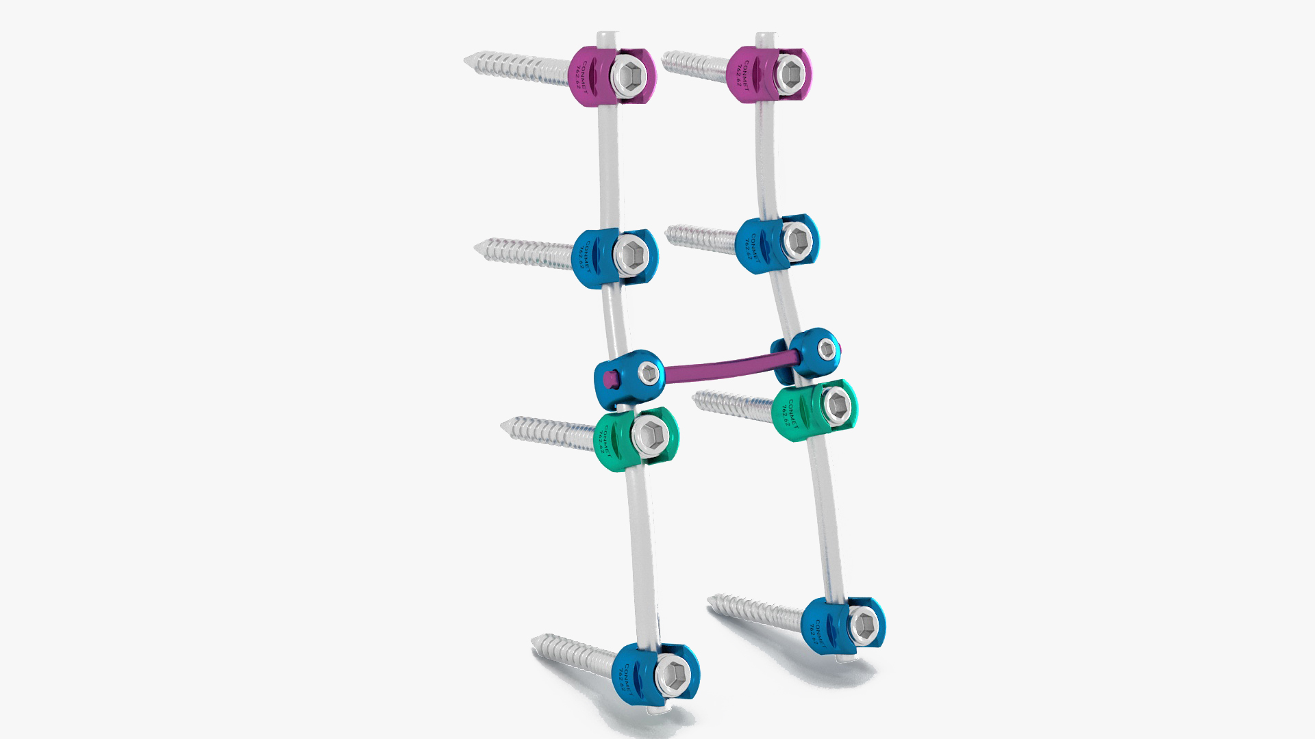 3D model Lumbar Cervical Spine Fixation System Colored
