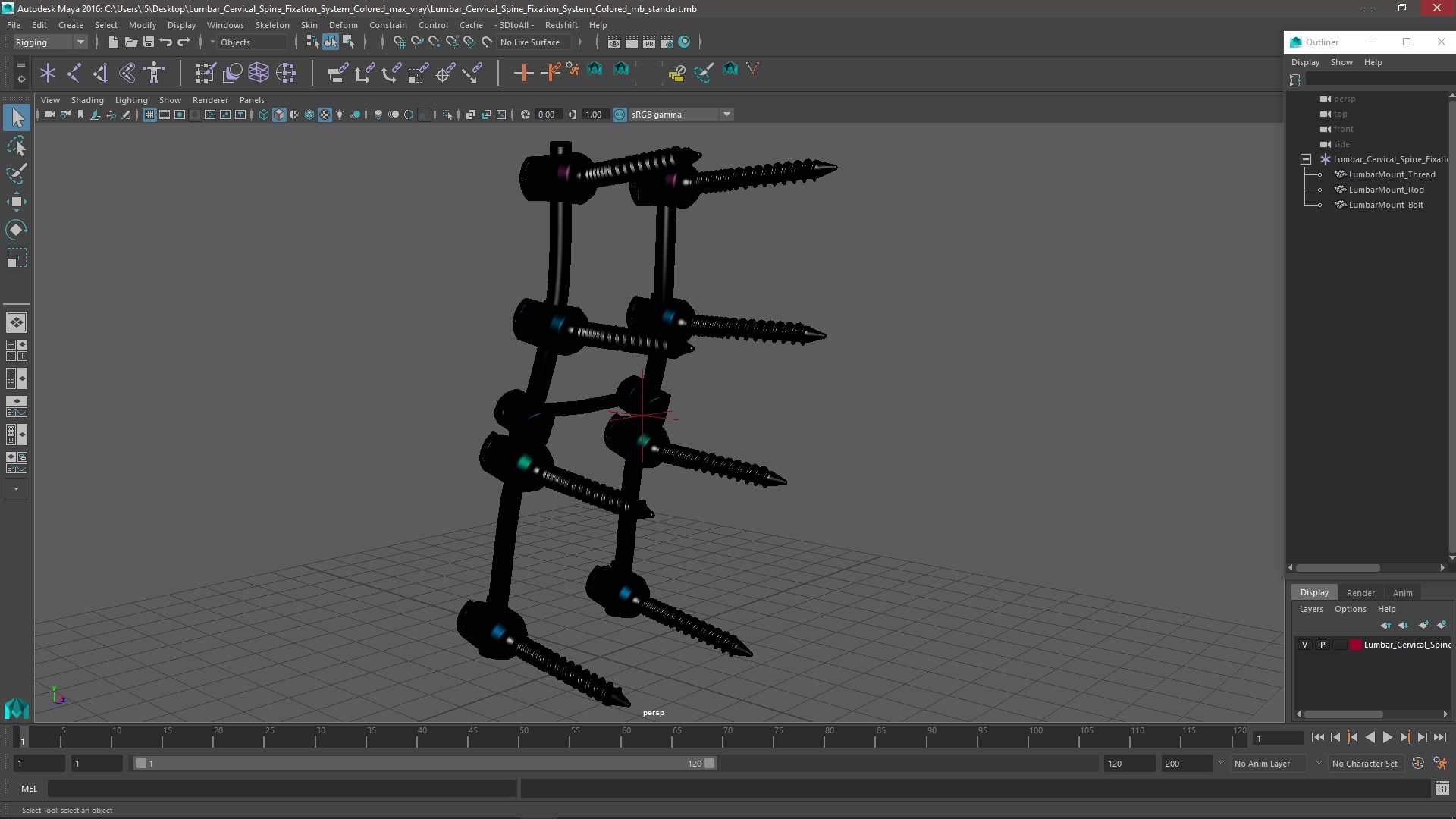 3D model Lumbar Cervical Spine Fixation System Colored