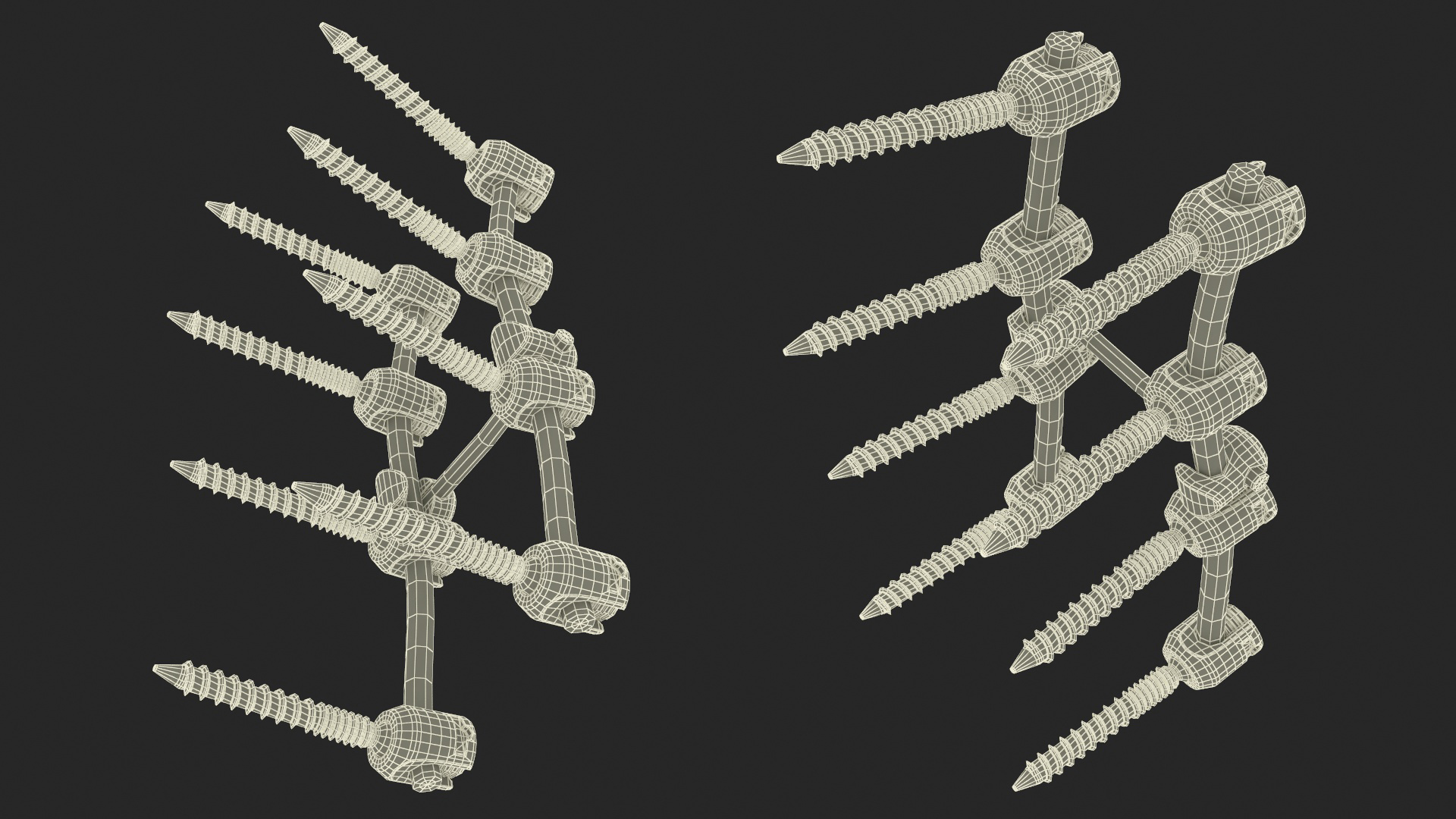 3D model Lumbar Cervical Spine Fixation System Colored