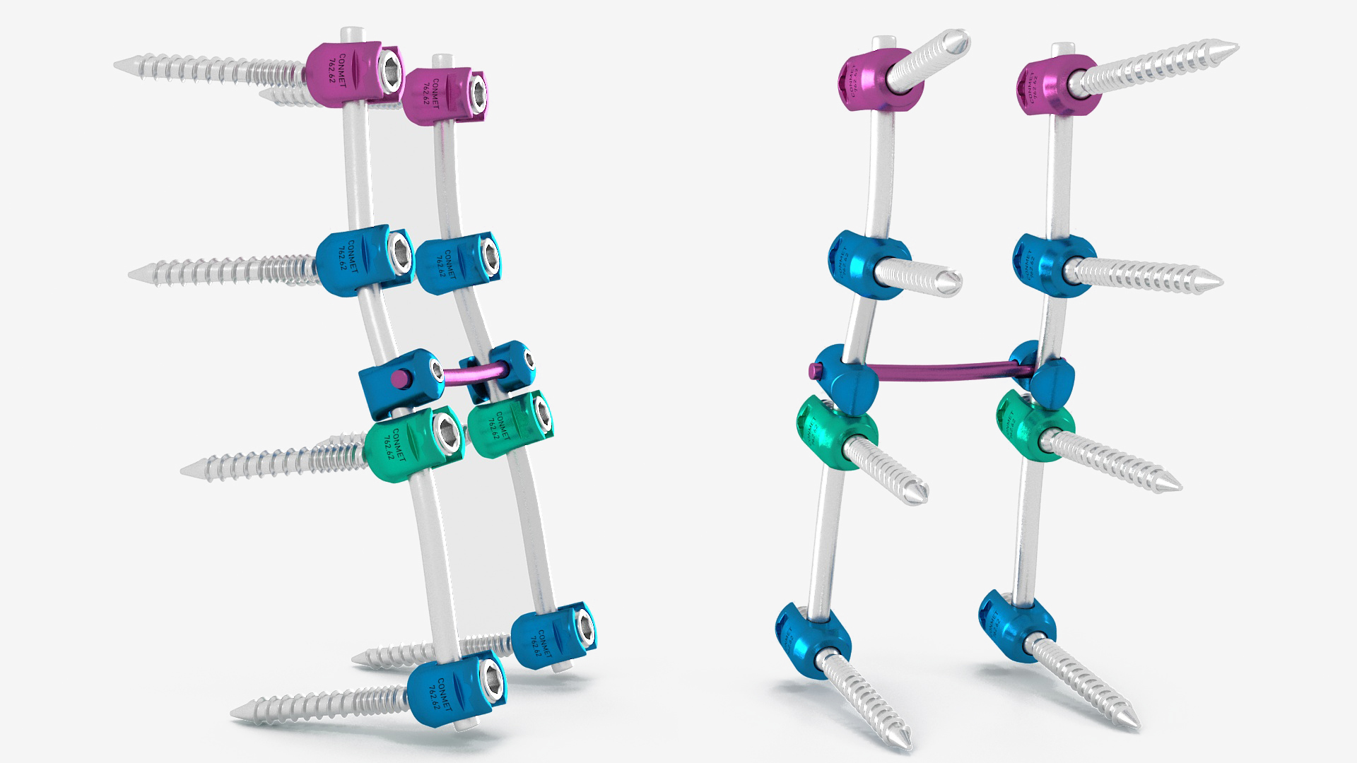 3D model Lumbar Cervical Spine Fixation System Colored
