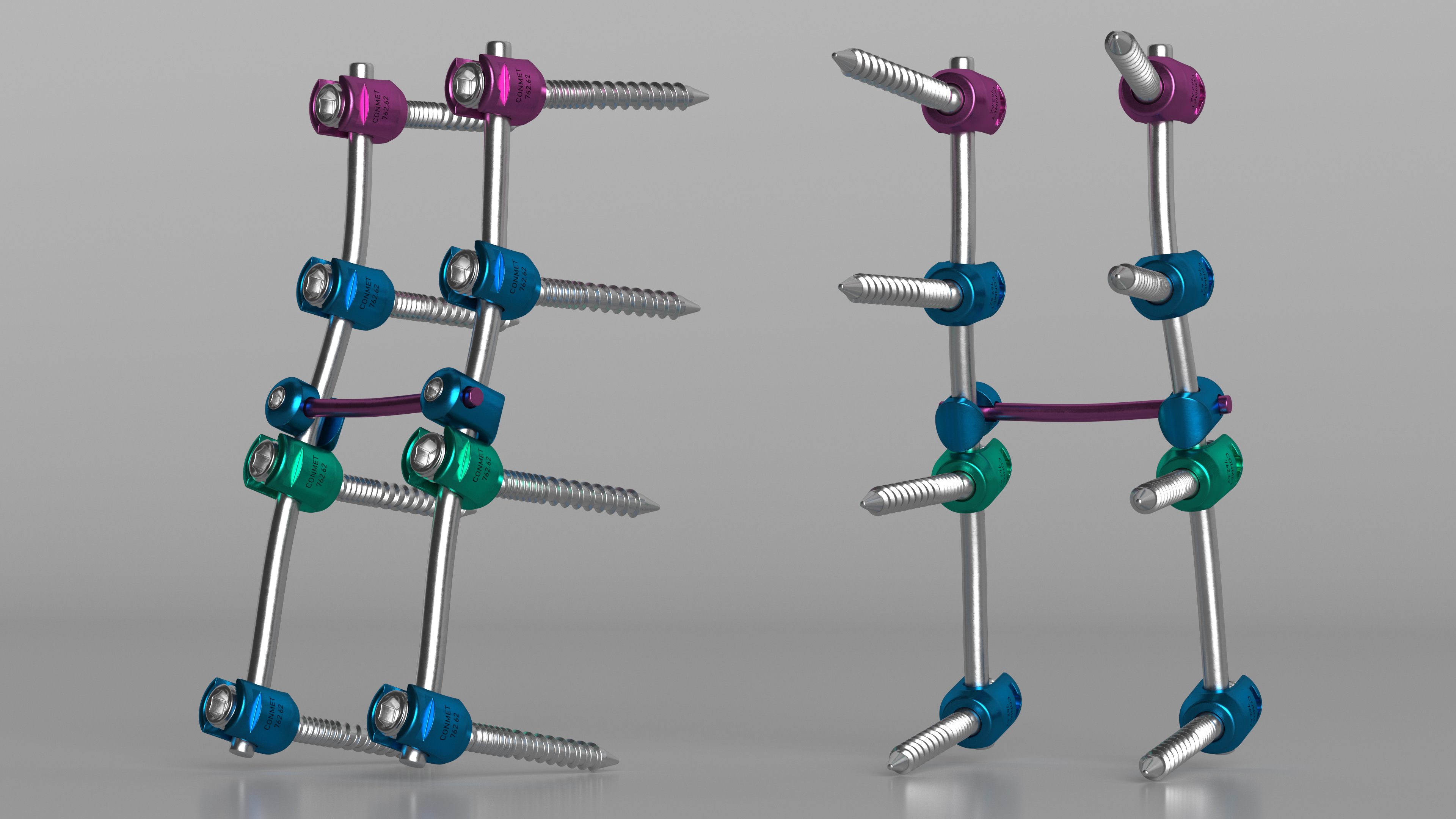 3D model Lumbar Cervical Spine Fixation System Colored