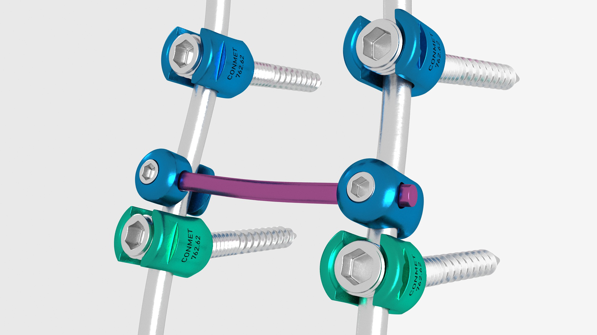 3D model Lumbar Cervical Spine Fixation System Colored