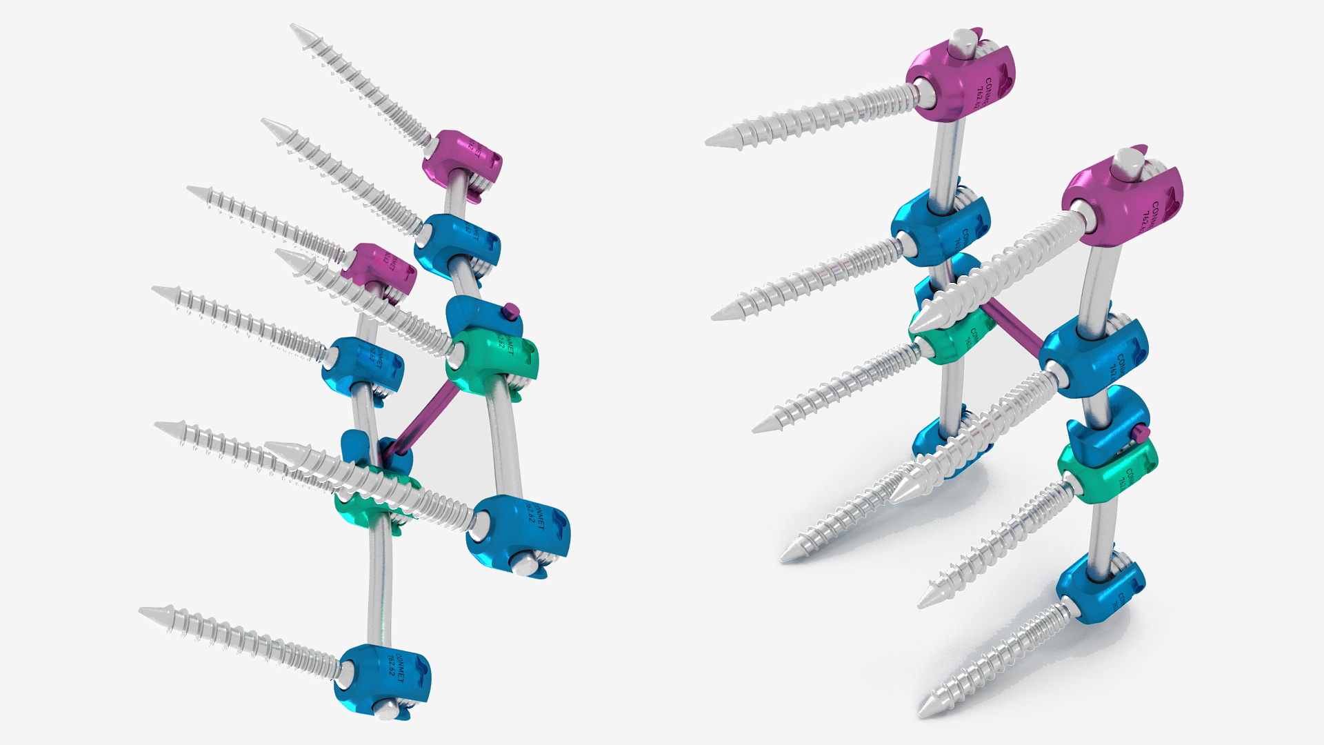 3D model Lumbar Cervical Spine Fixation System Colored