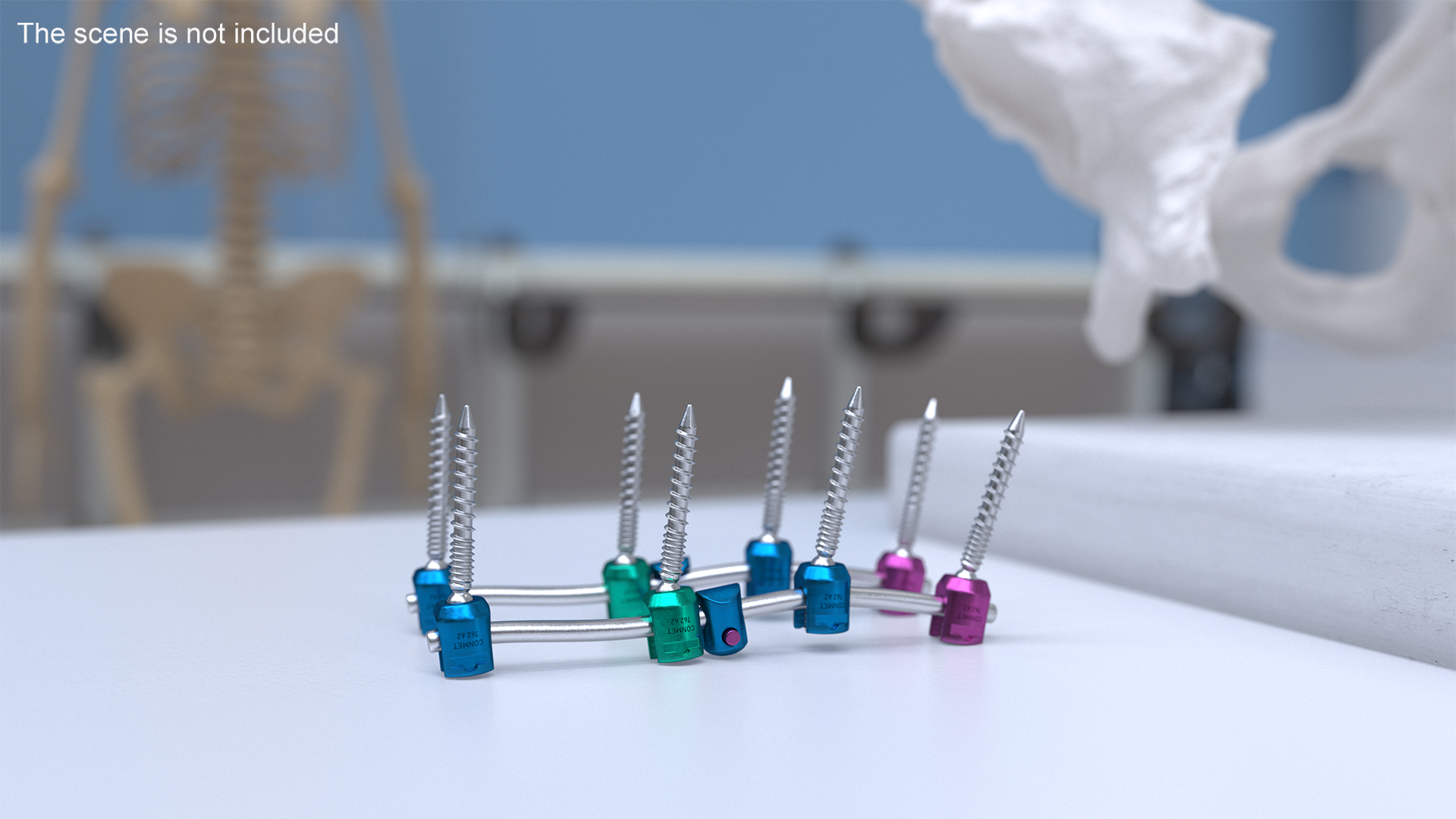 3D model Lumbar Cervical Spine Fixation System Colored