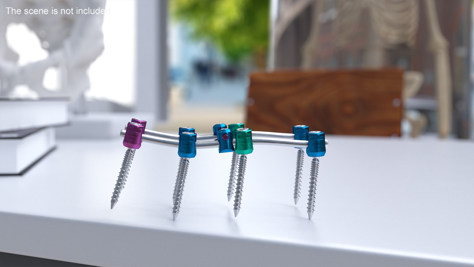 3D model Lumbar Cervical Spine Fixation System Colored