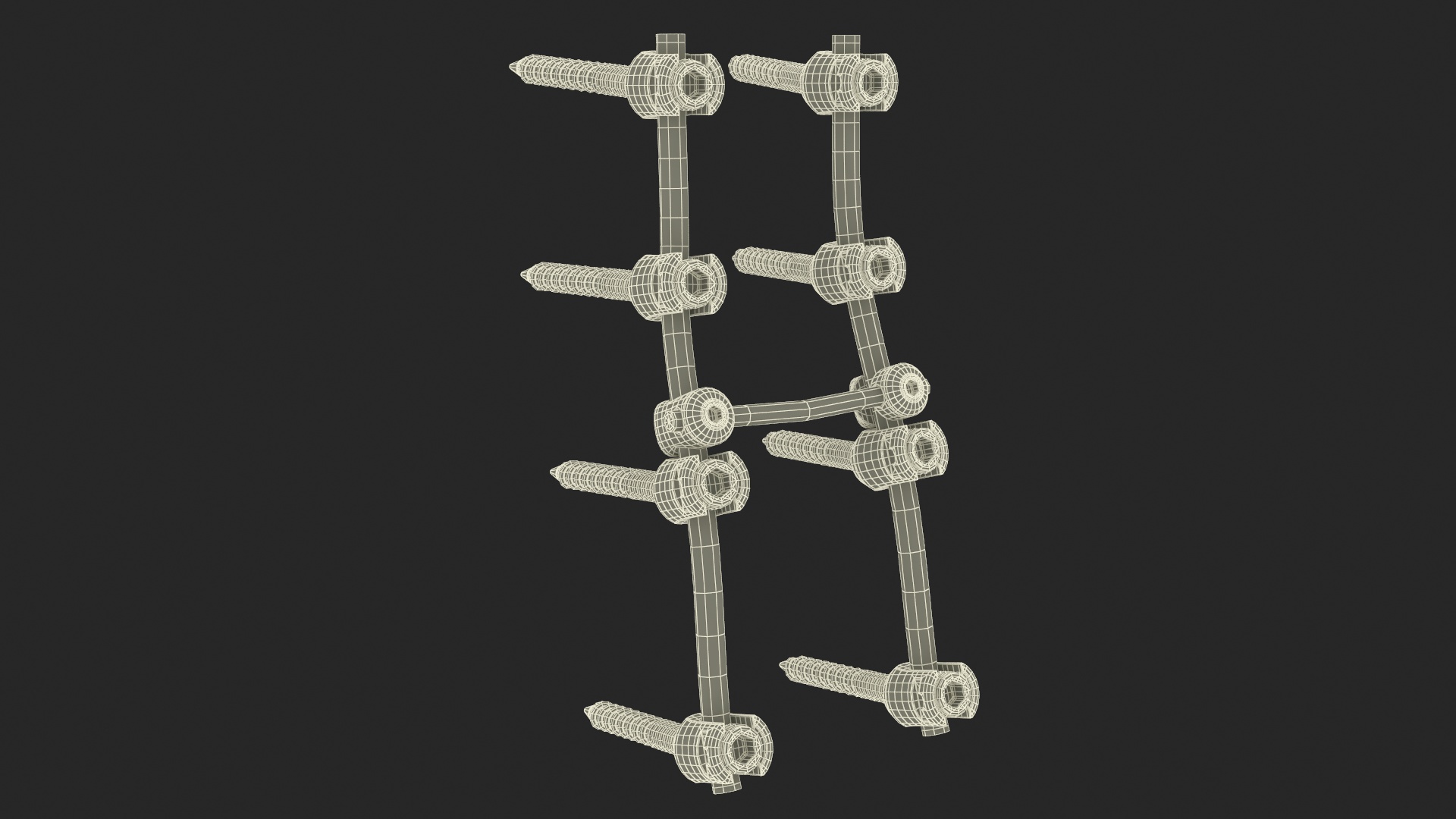 3D model Lumbar Cervical Spine Fixation System Colored