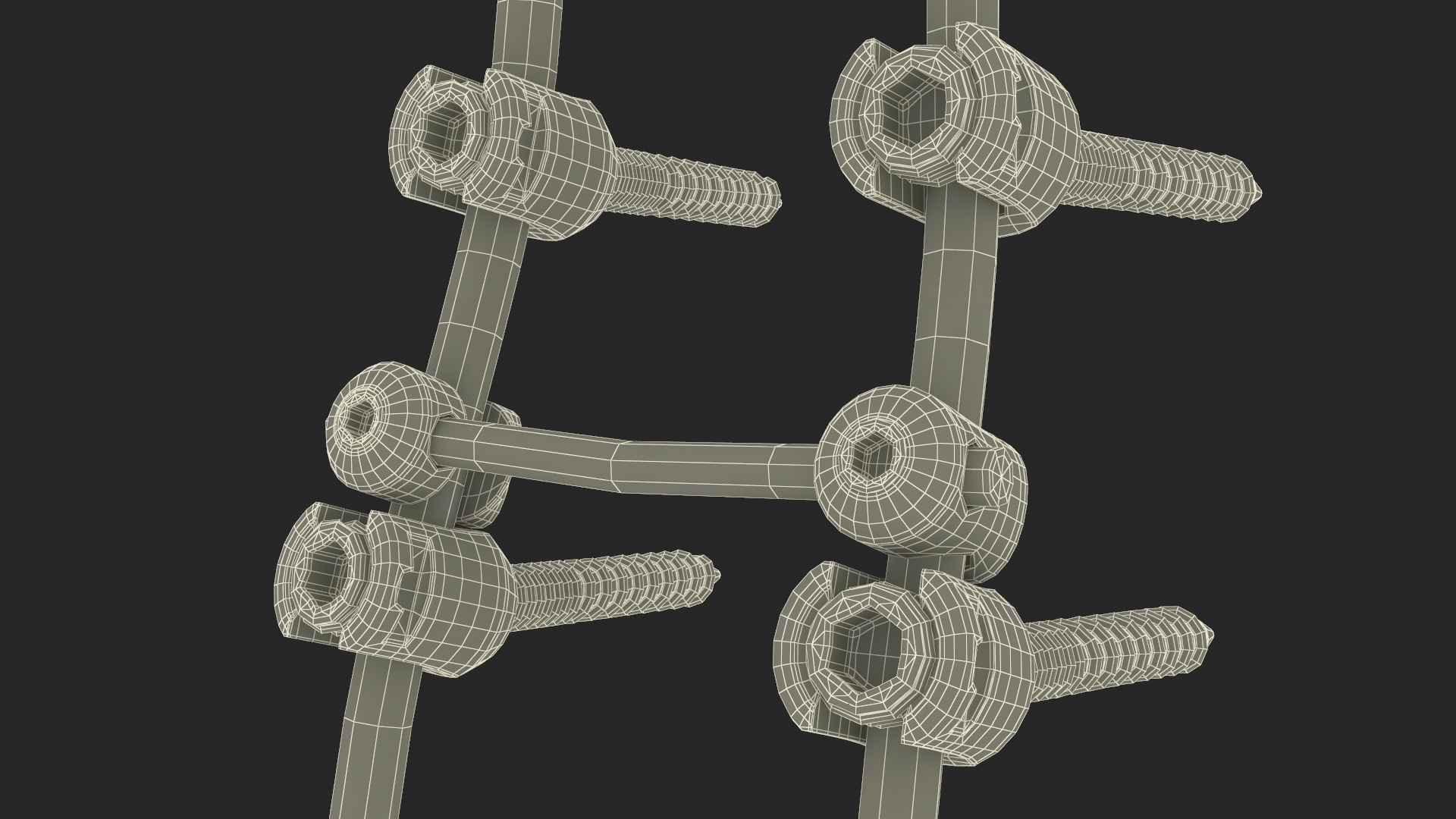 3D model Lumbar Cervical Spine Fixation System Colored