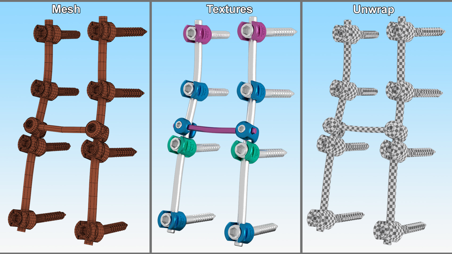 3D model Lumbar Cervical Spine Fixation System Colored