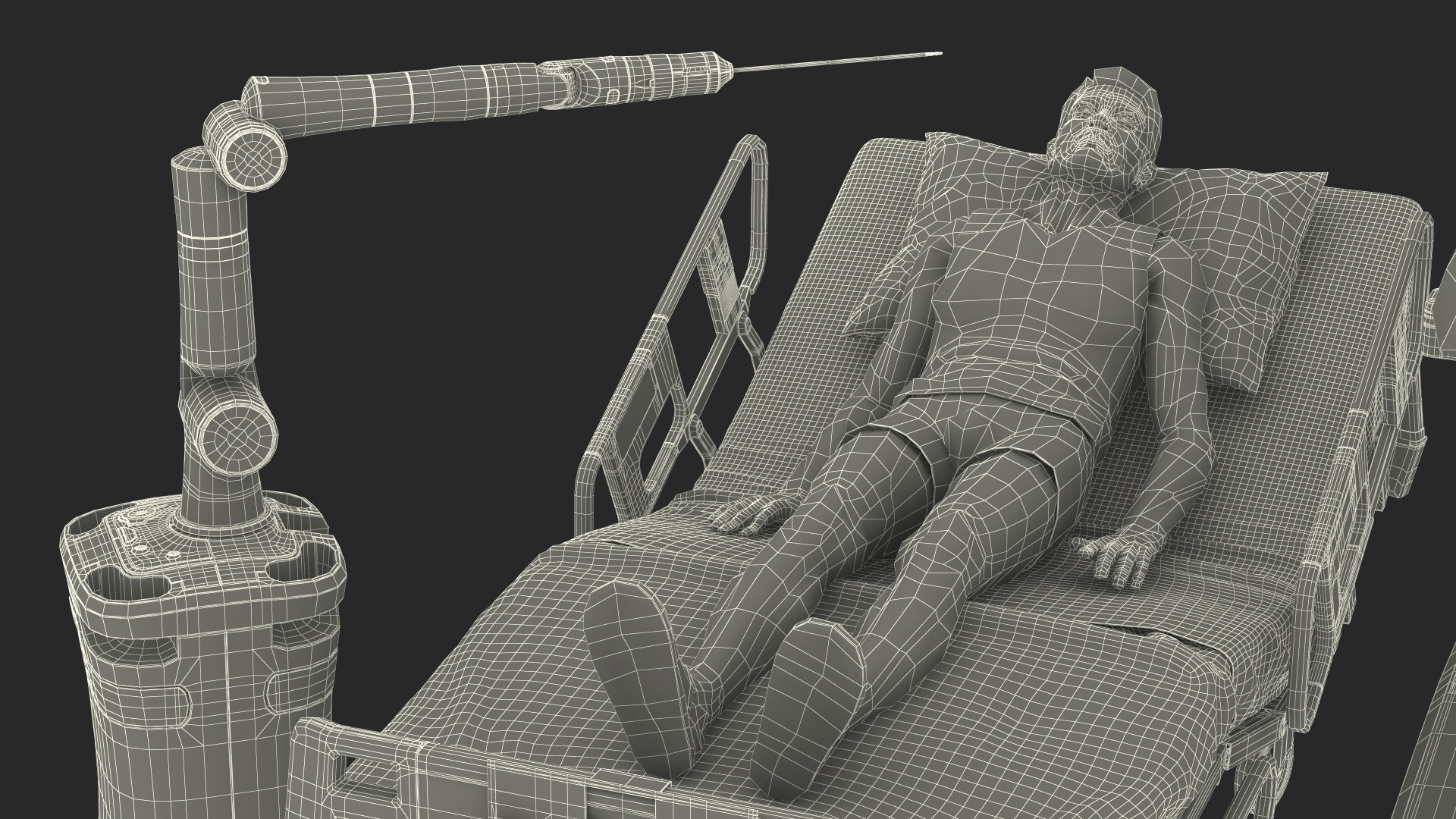 3D model Versius CMR Surgical with Patient on Hospital Bed and Doctor