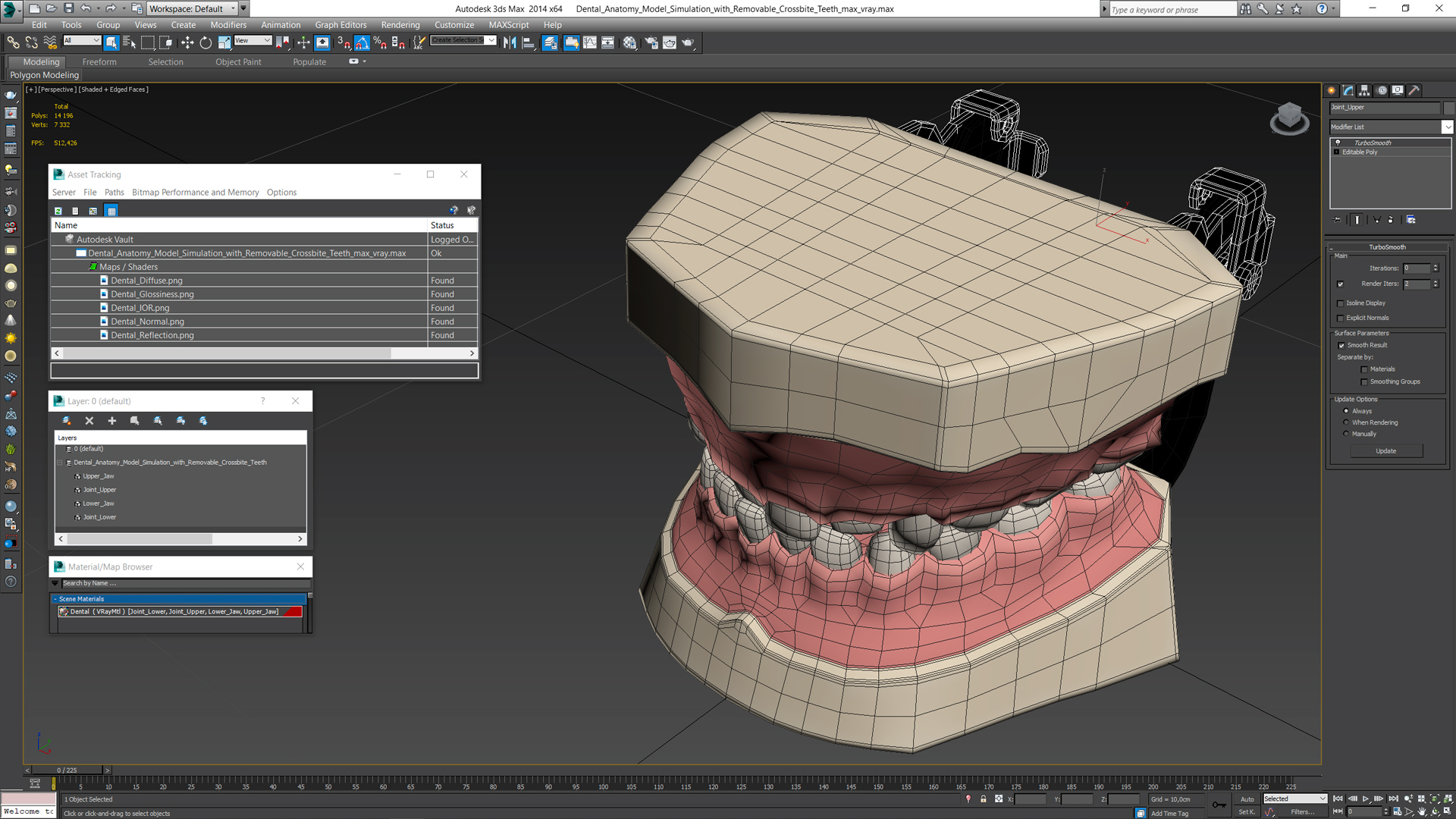 Dental Anatomy Model Simulation with Removable Crossbite Teeth 3D