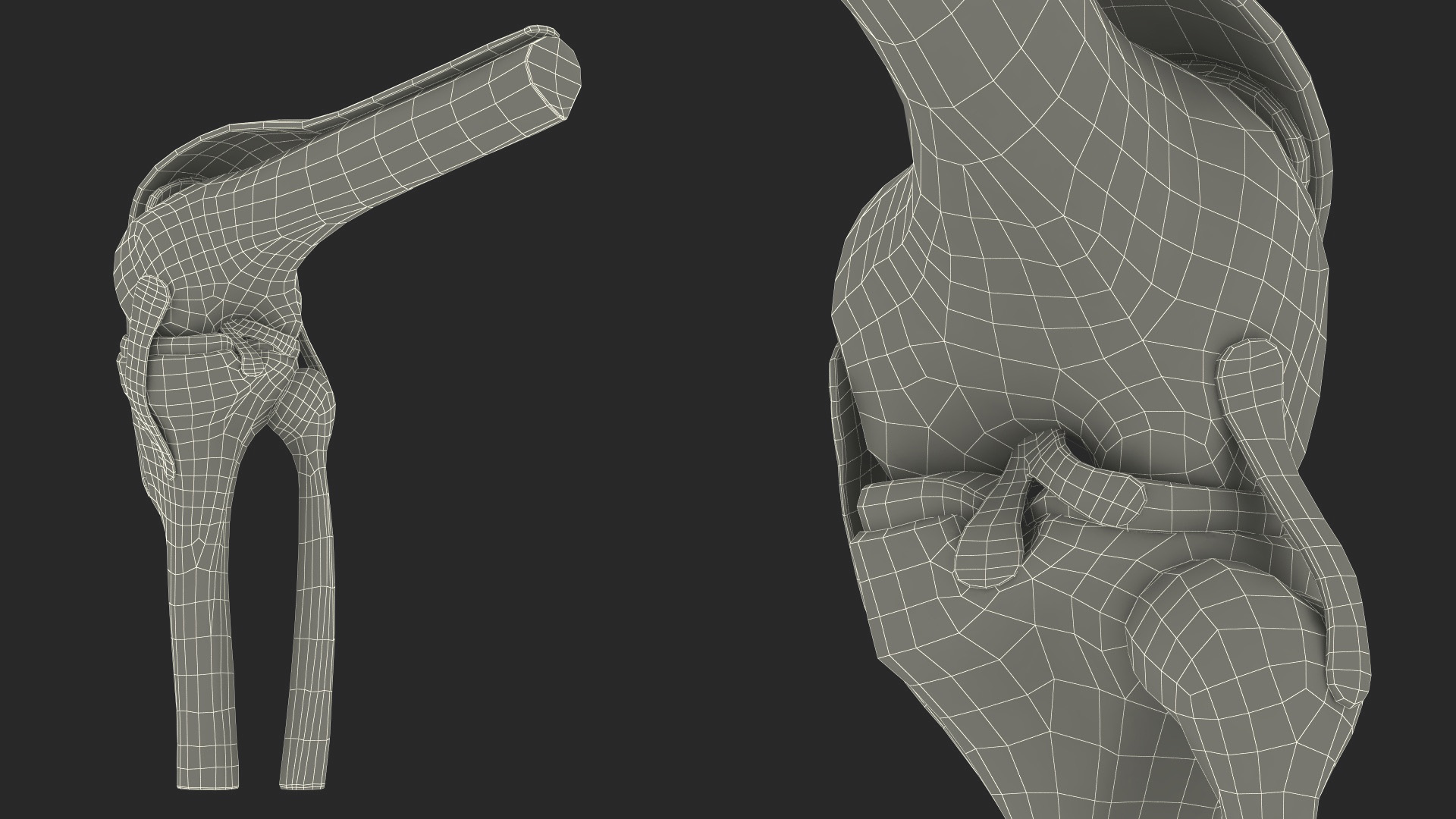 Knee Joint Model Bent State 3D