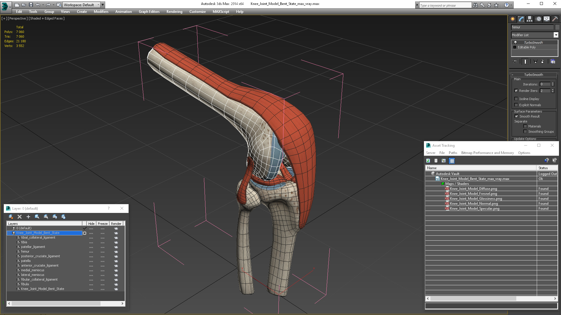 Knee Joint Model Bent State 3D