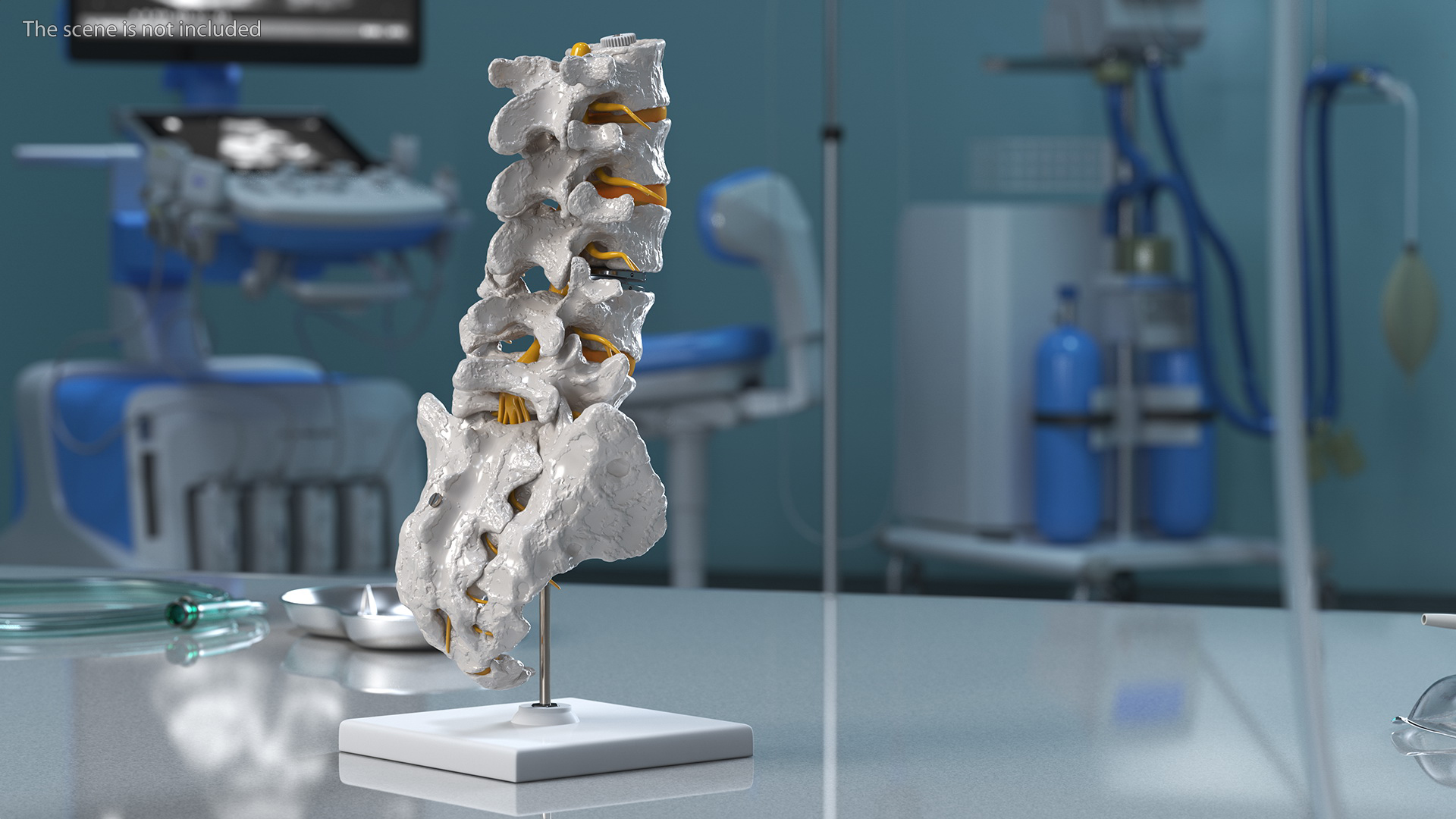 3D Intervertebral Disc Implant Installed on Spine