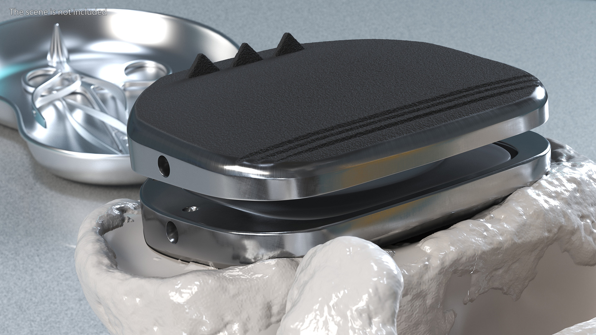 3D Intervertebral Disc Implant Installed on Spine