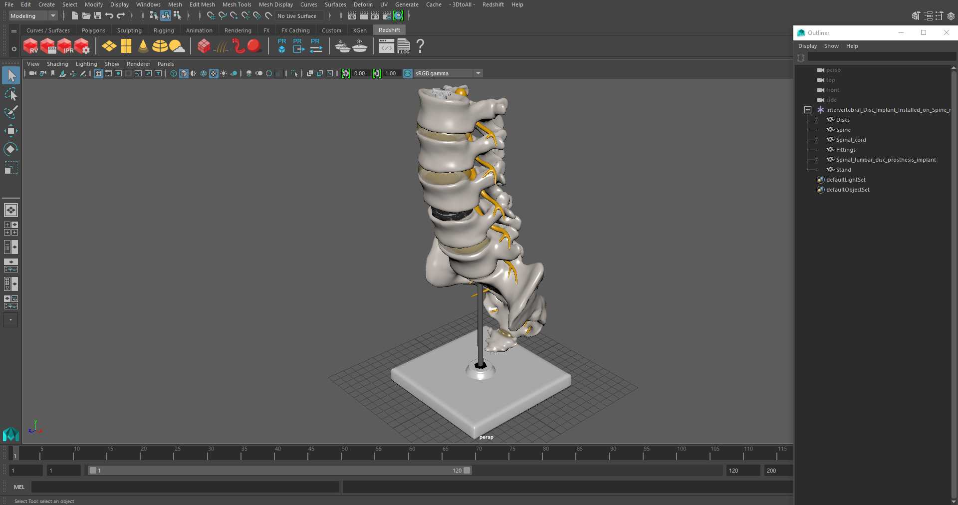 3D Intervertebral Disc Implant Installed on Spine