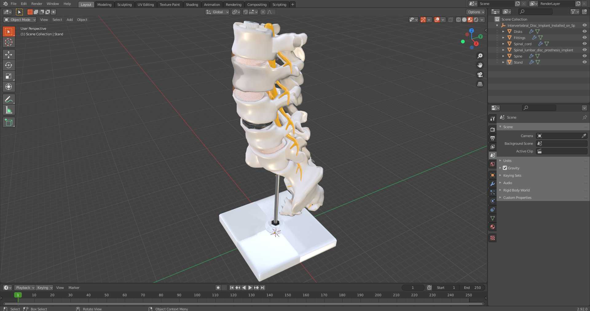 3D Intervertebral Disc Implant Installed on Spine