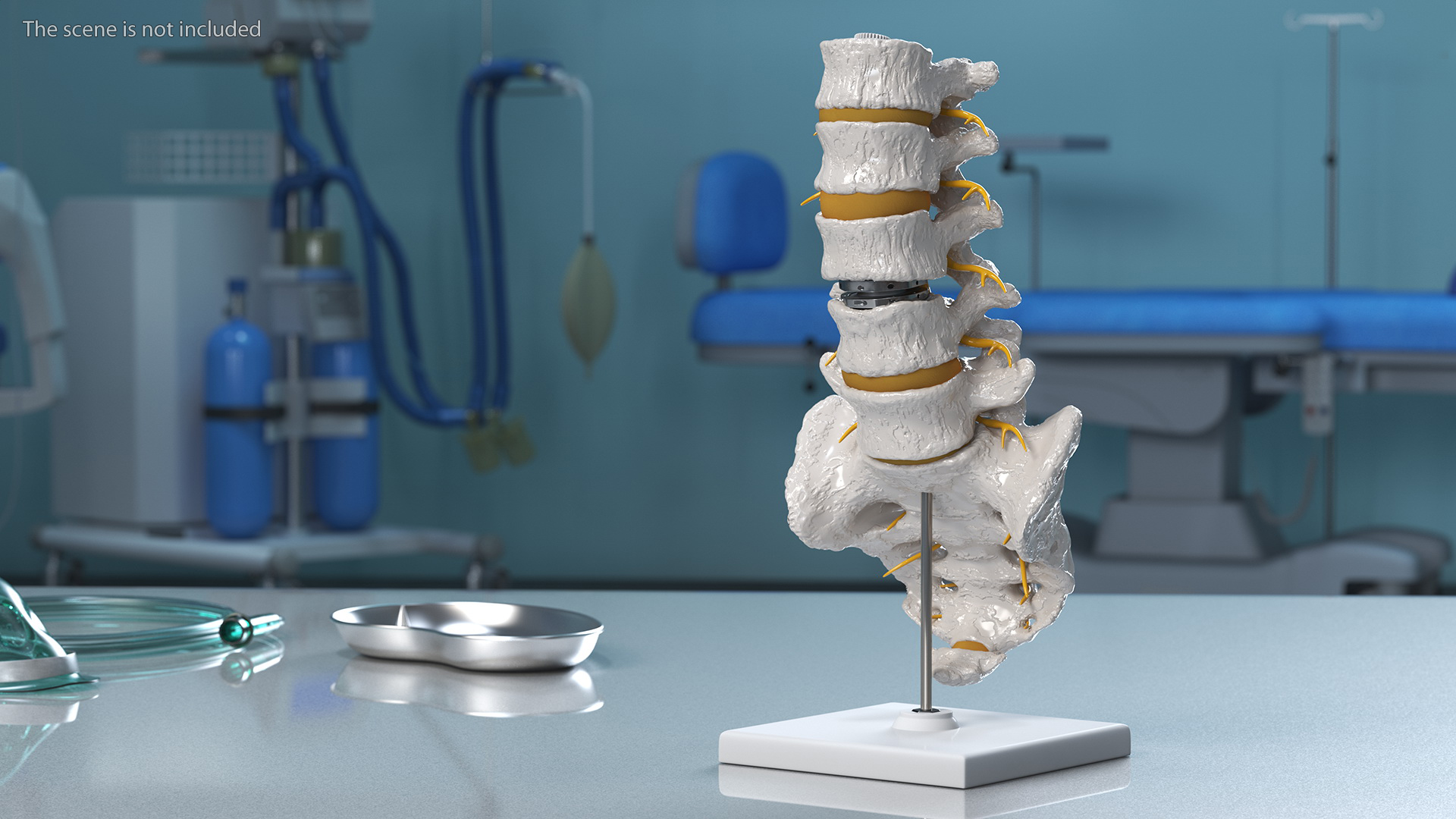 3D Intervertebral Disc Implant Installed on Spine