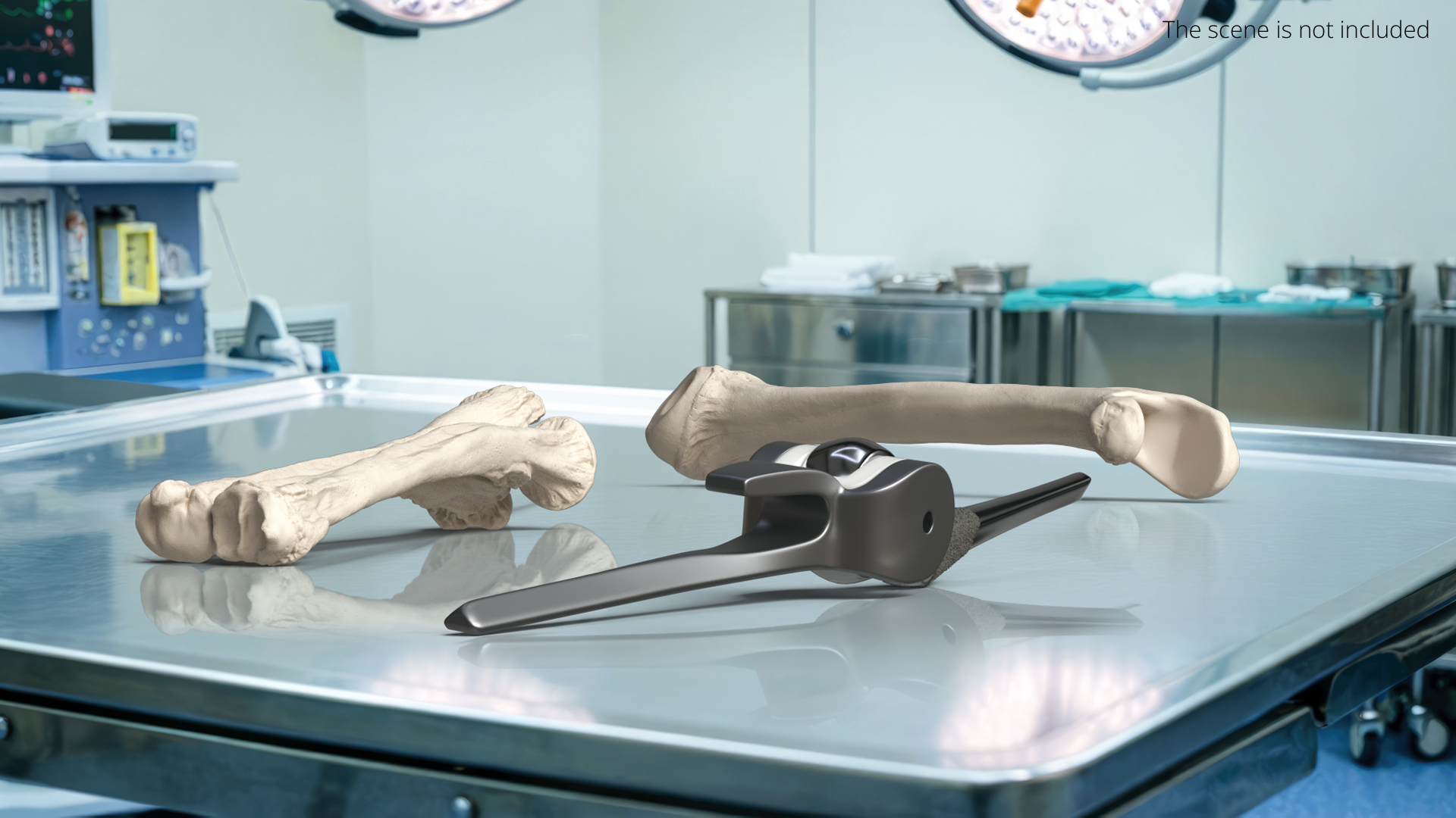 Elbow Joint Implant with Humerus and Ulna, view 2