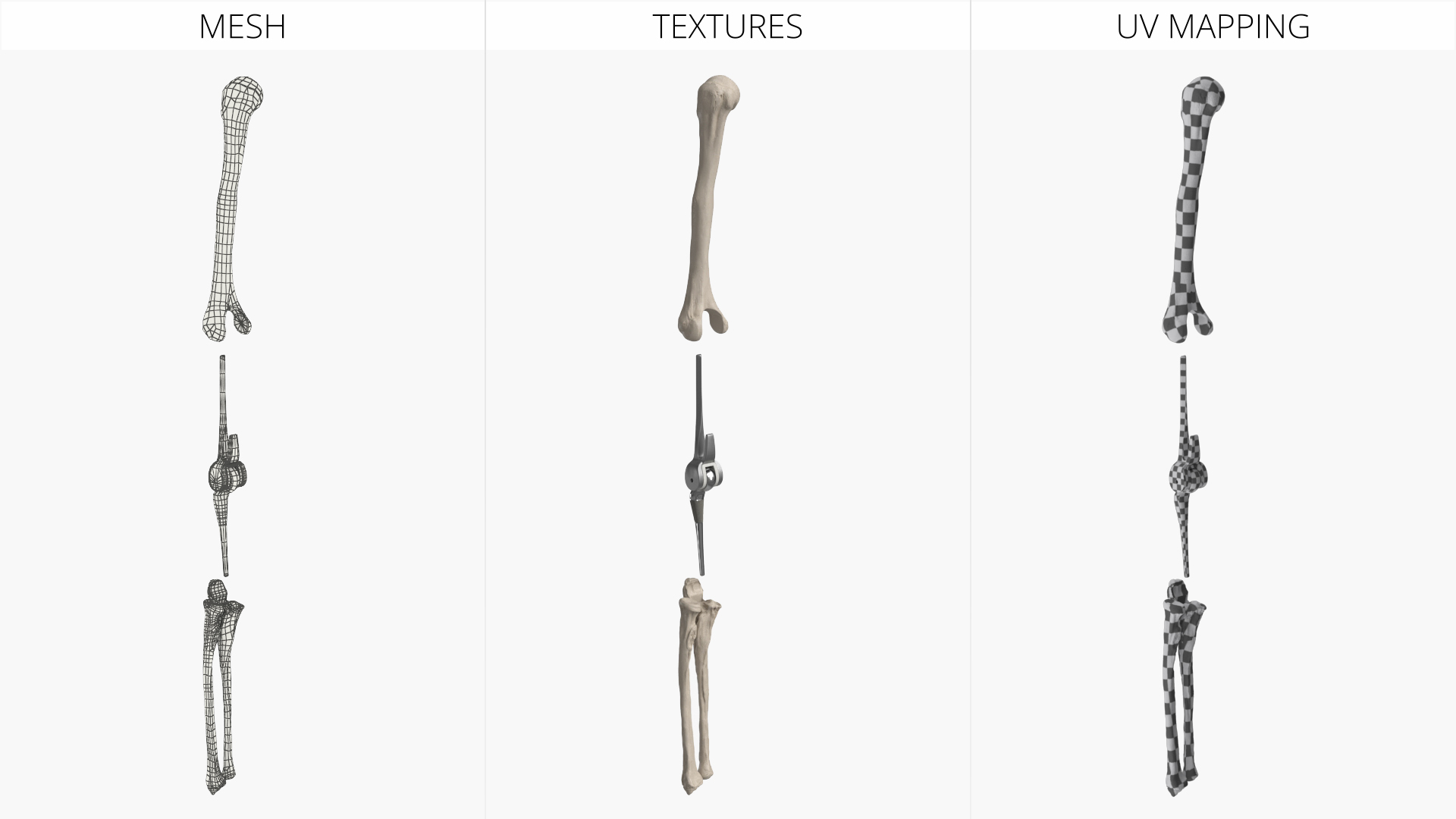 Elbow Joint Implant with Humerus and Ulna, view 7