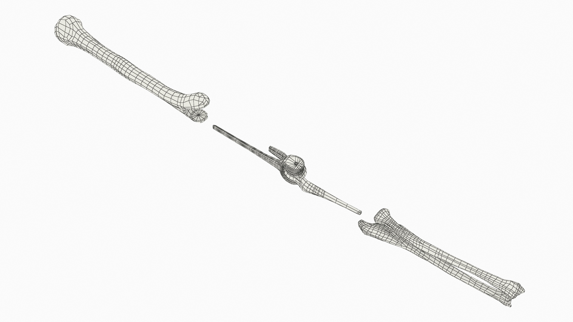Elbow Joint Implant with Humerus and Ulna, view 10