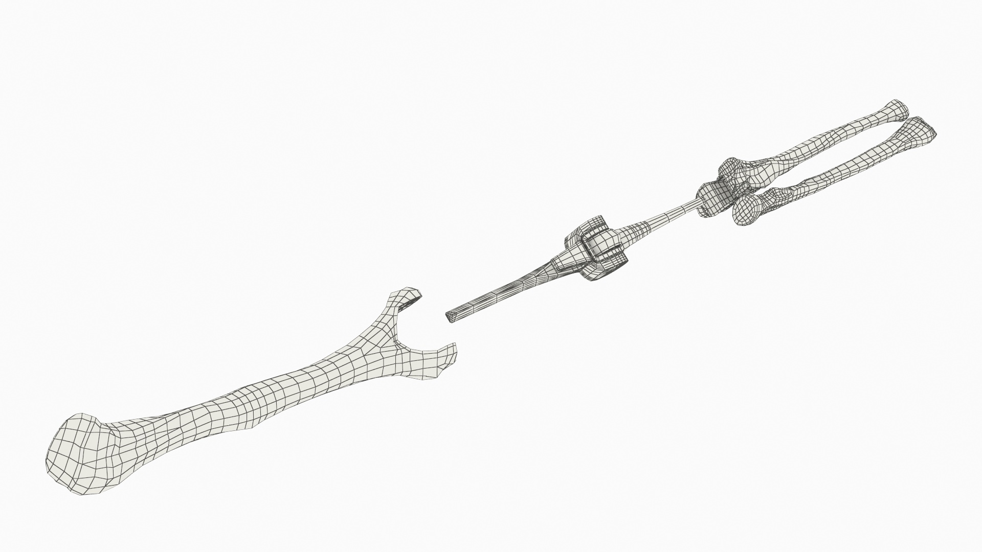 Elbow Joint Implant with Humerus and Ulna, view 11