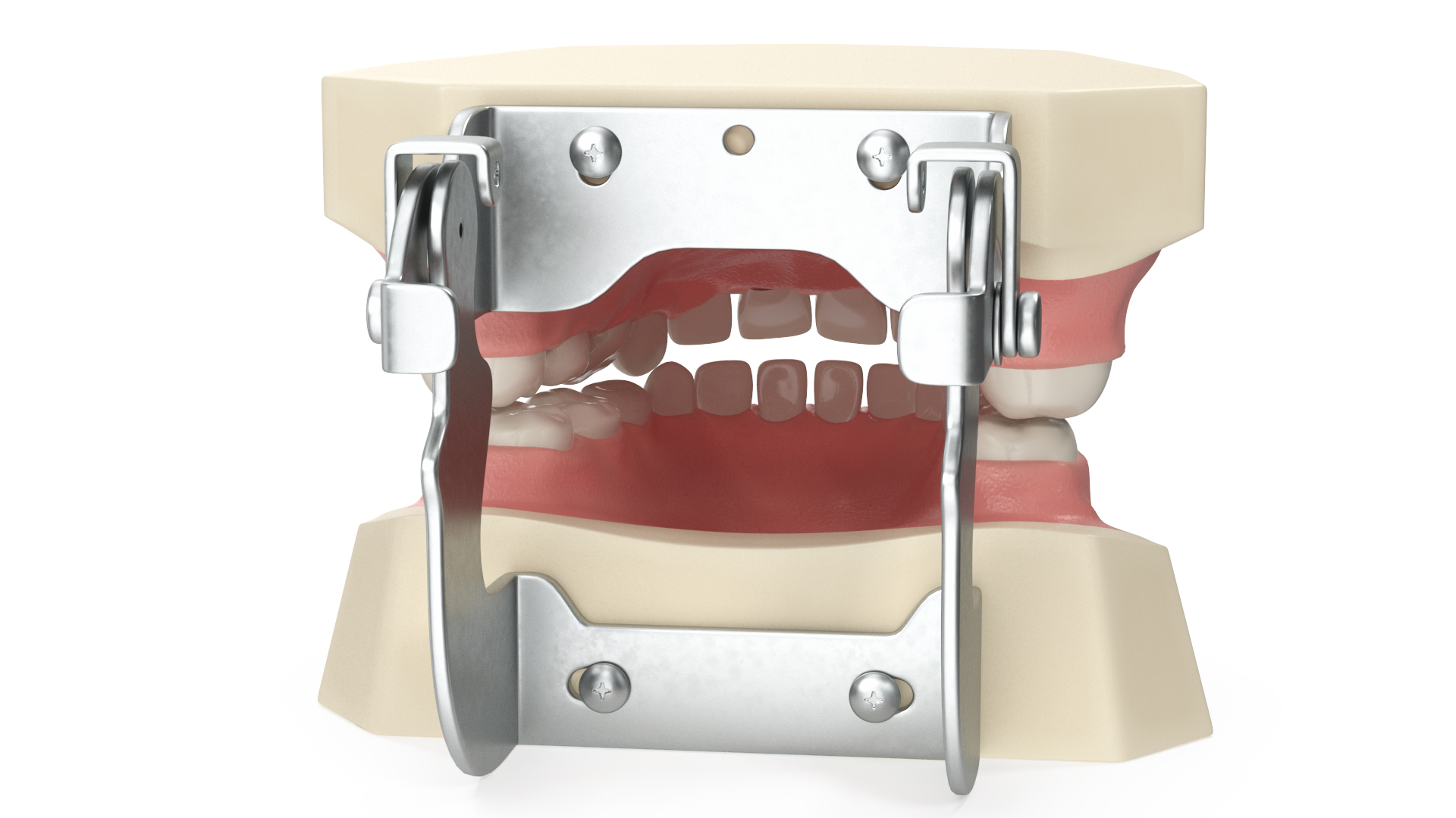 3D Dental Anatomy Educational Pediatric Kit with Removable Open Bite Teeth