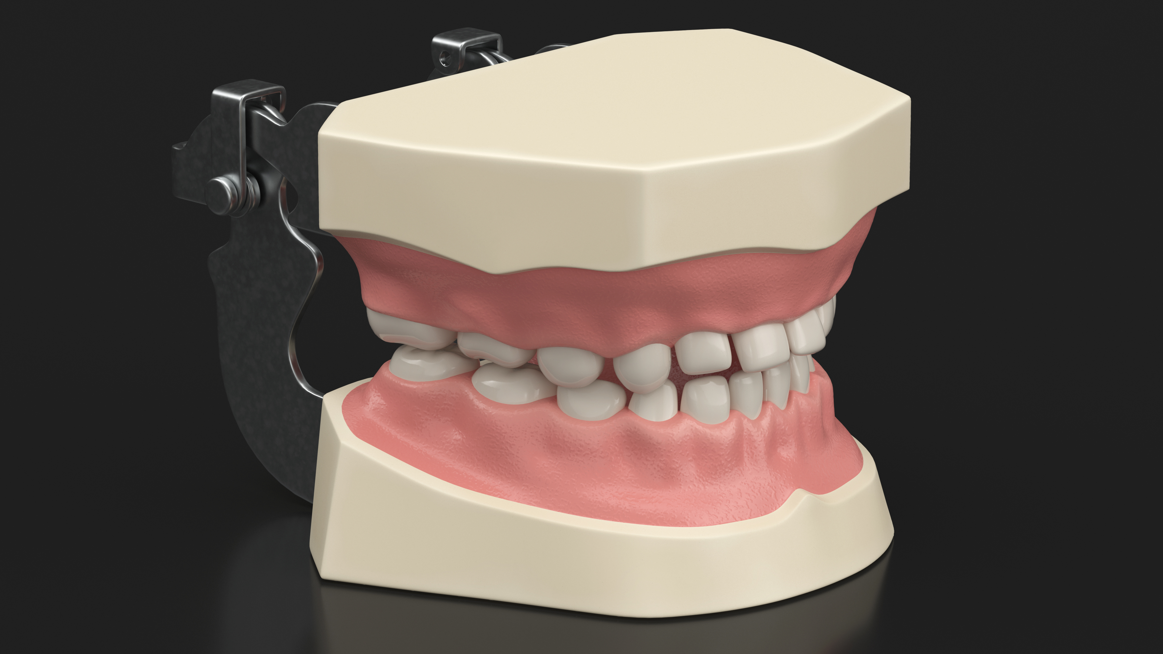 3D Dental Anatomy Educational Pediatric Kit with Removable Open Bite Teeth