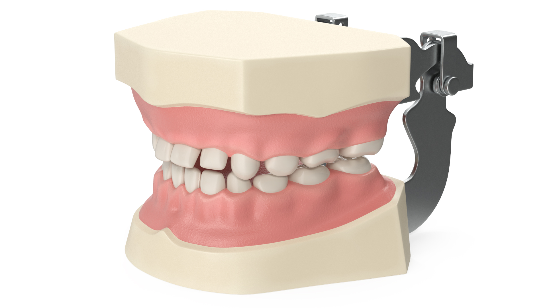 3D Dental Anatomy Educational Pediatric Kit with Removable Open Bite Teeth