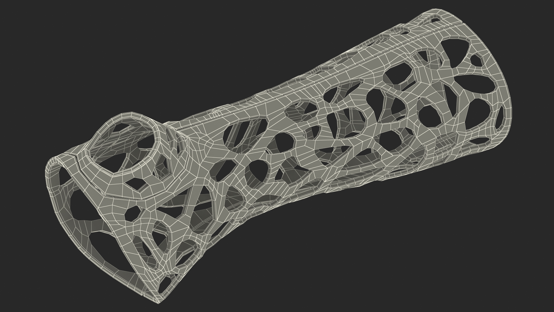 3D 3D-Printed Orthopedic Cast Hand Yellow model