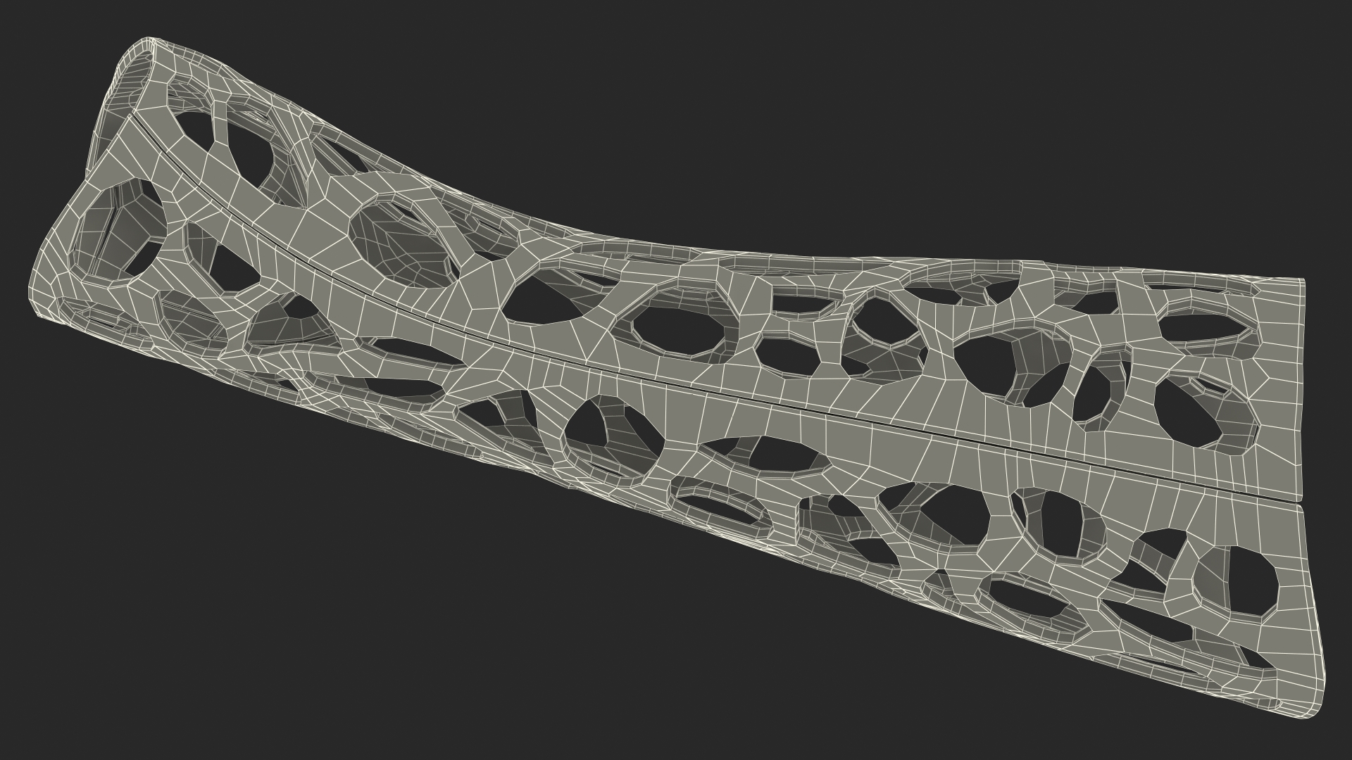 3D 3D-Printed Orthopedic Cast Hand Yellow model