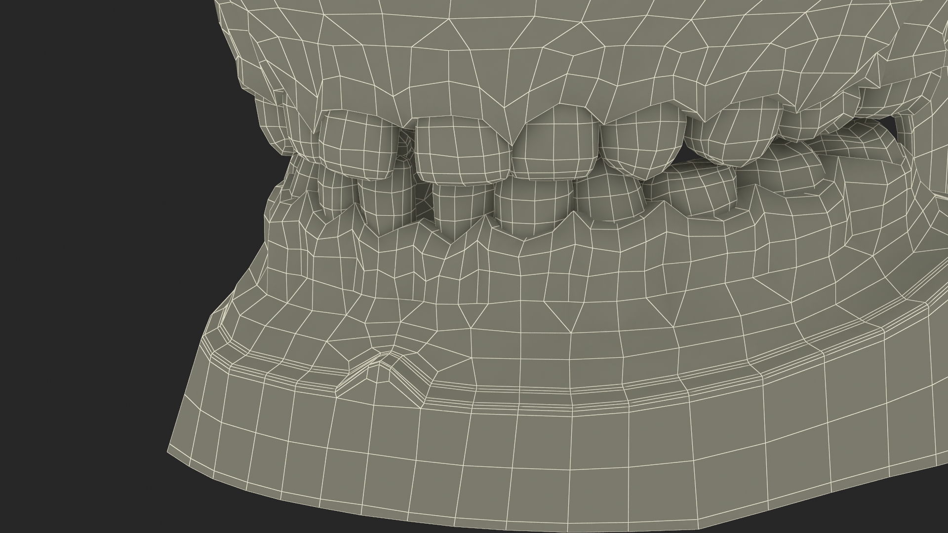 3D Pediatric Typodont Demonstration Model with Removable Gapped Teeth