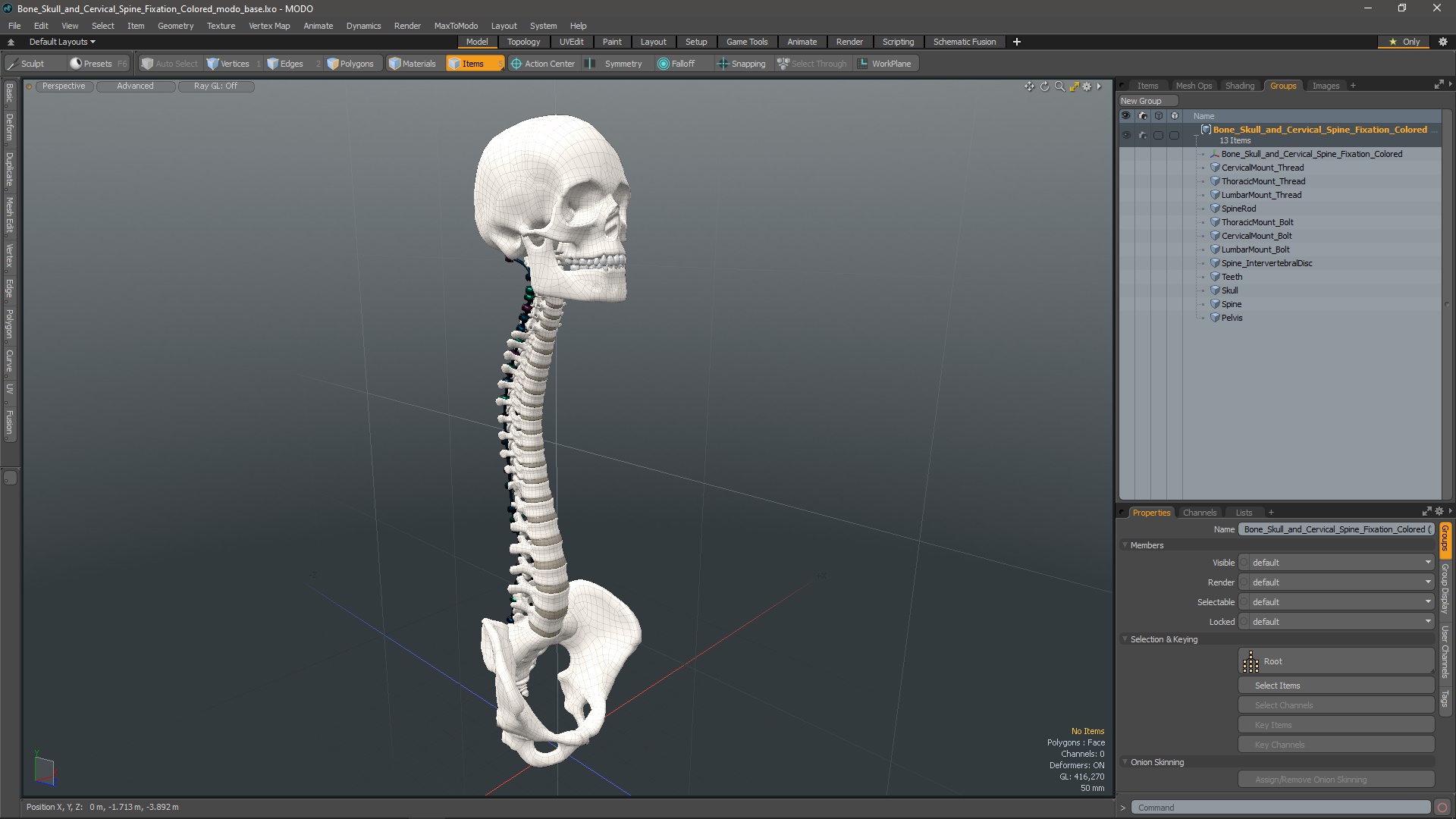 3D Bone Skull and Cervical Spine Fixation Colored